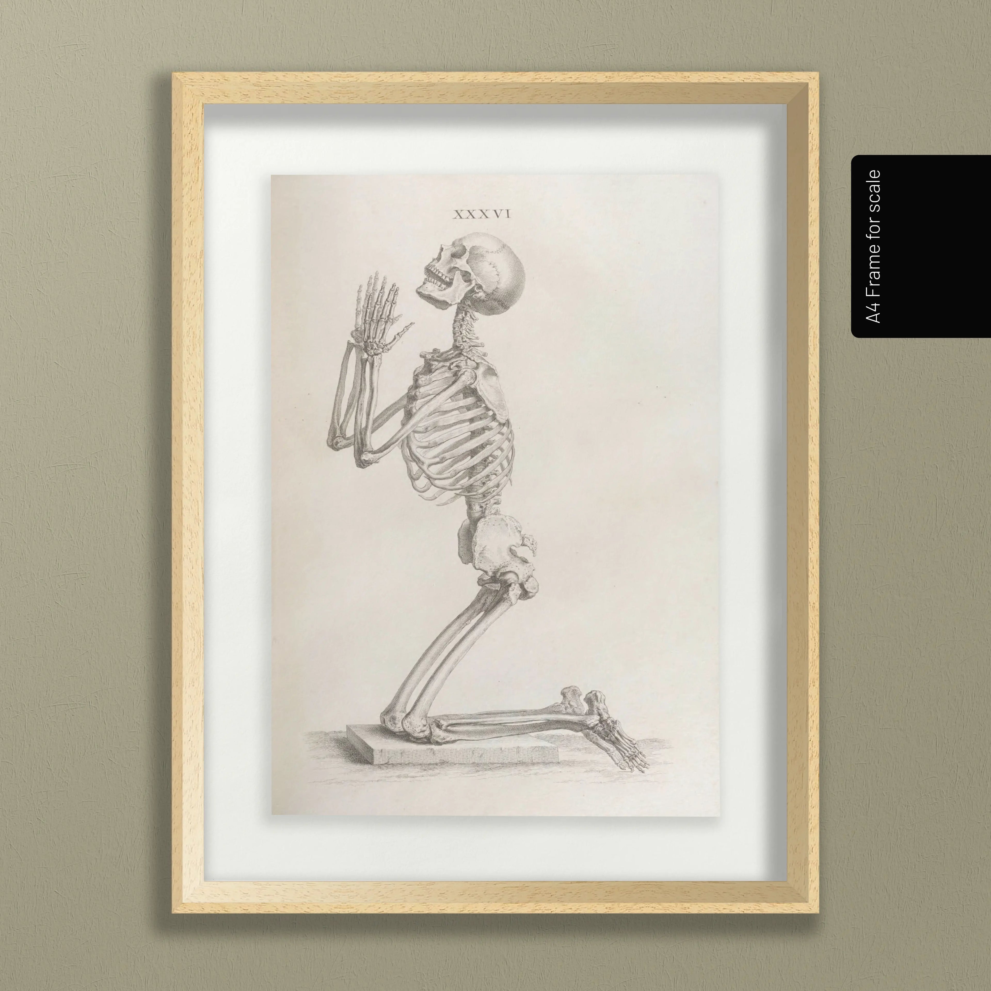 Anatomy: Plate No. 30