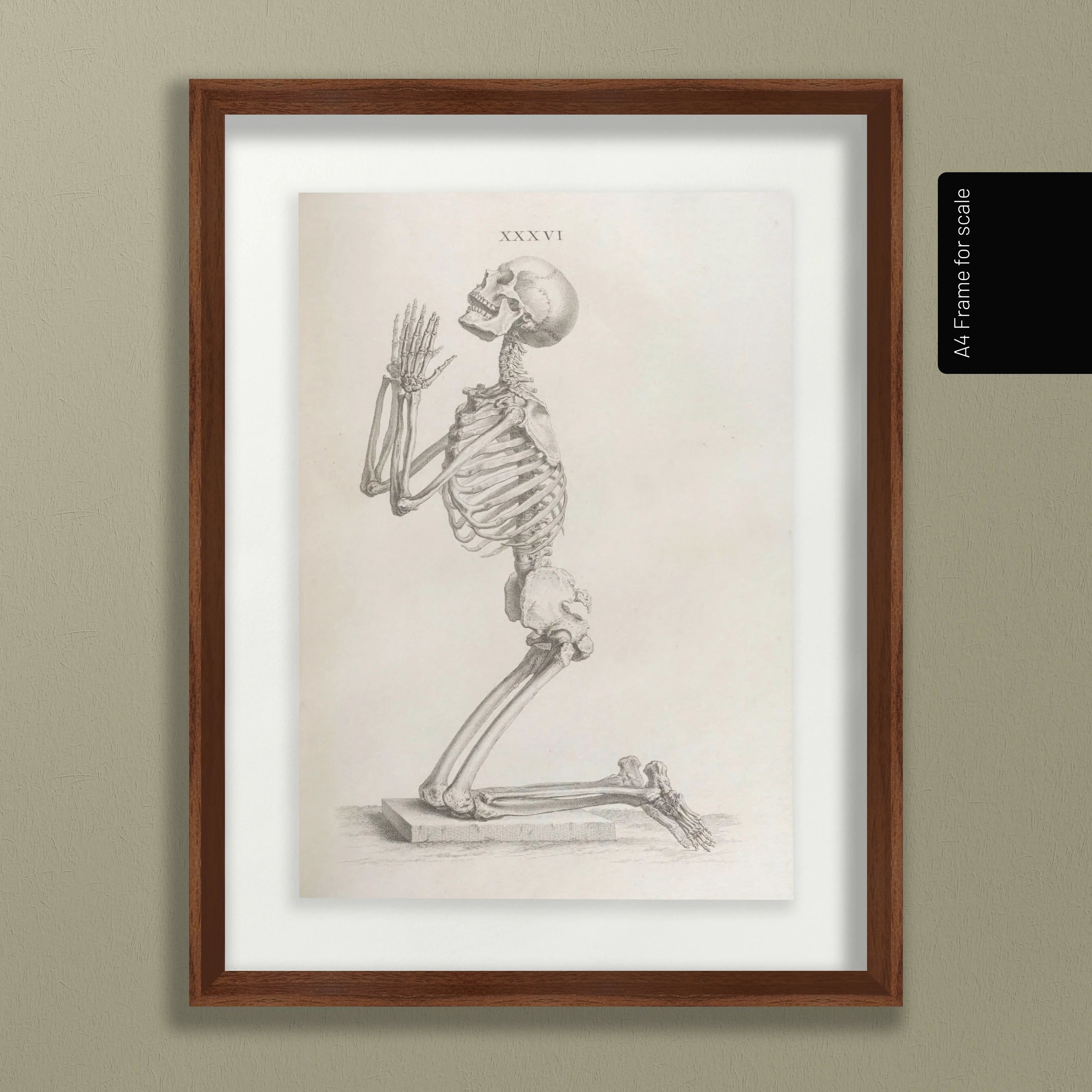 Anatomy: Plate No. 30