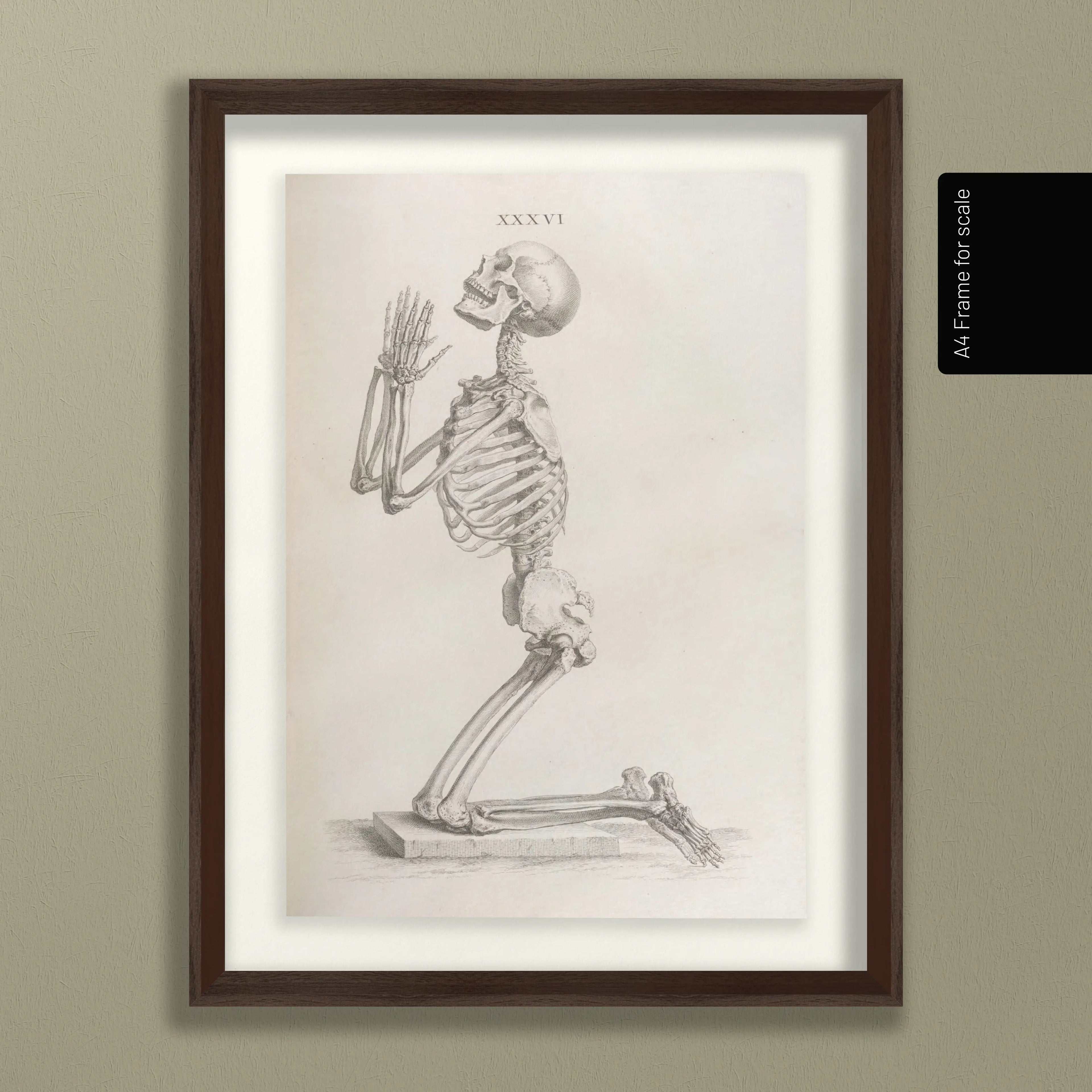 Anatomy: Plate No. 30