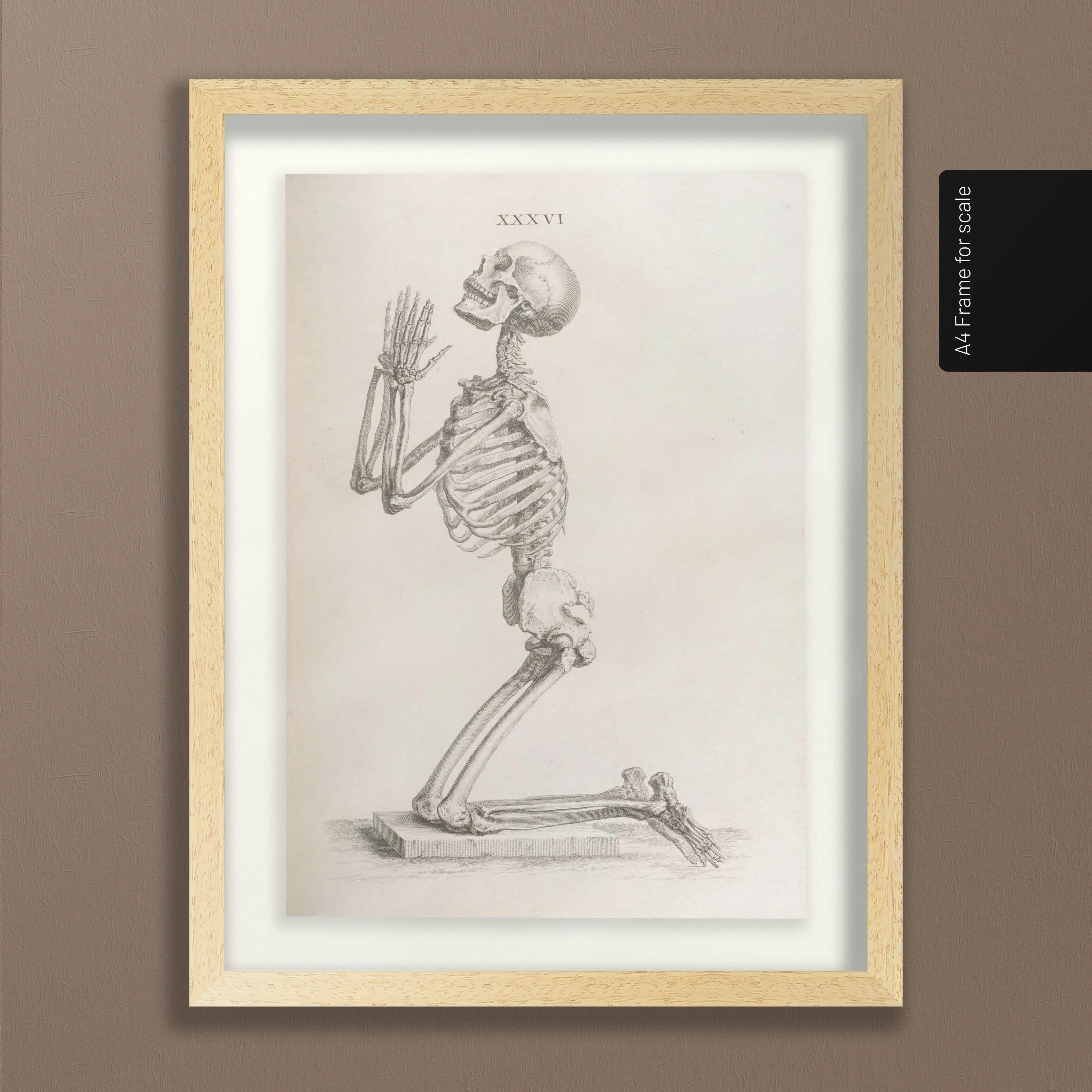 Anatomy: Plate No. 30