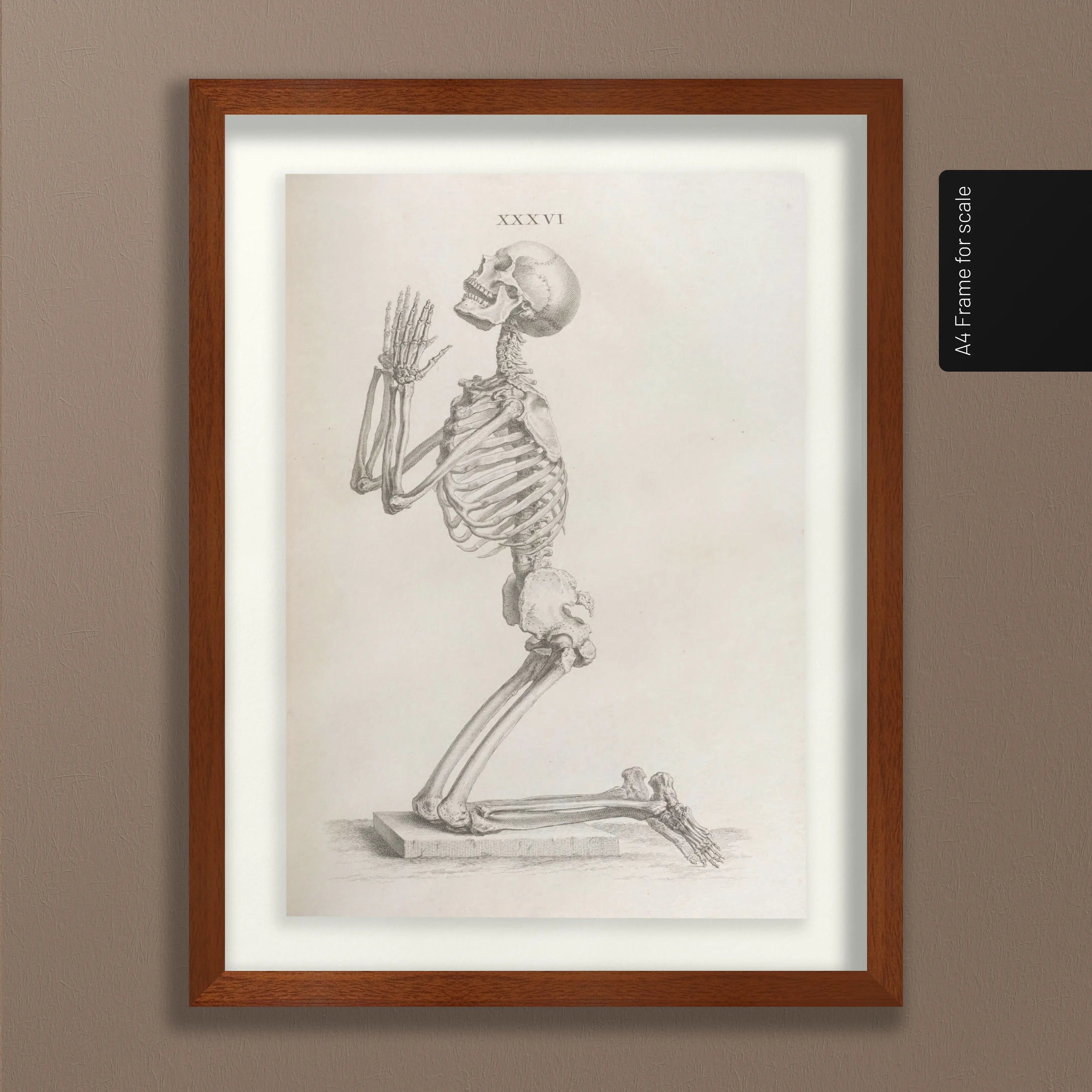 Anatomy: Plate No. 30