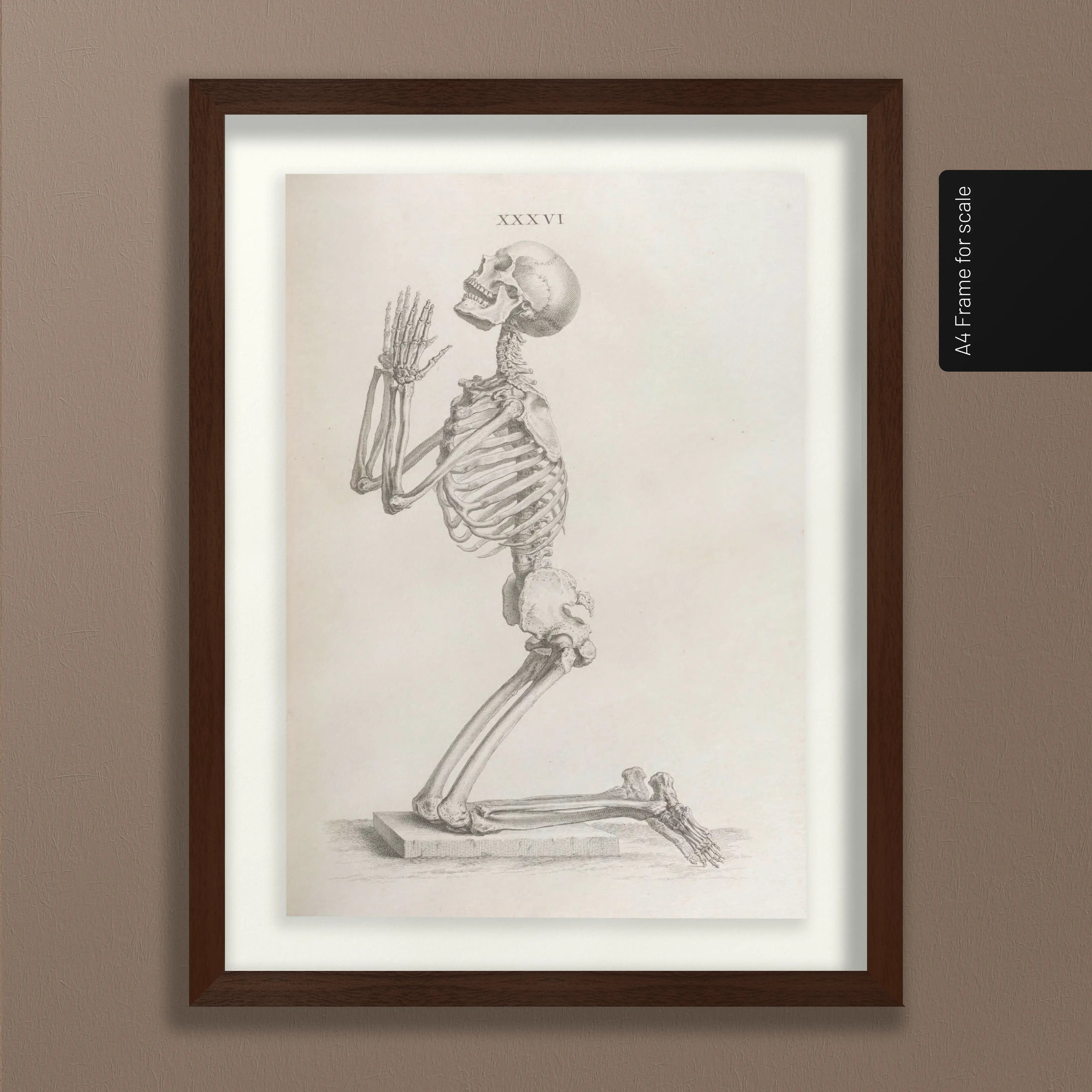 Anatomy: Plate No. 30