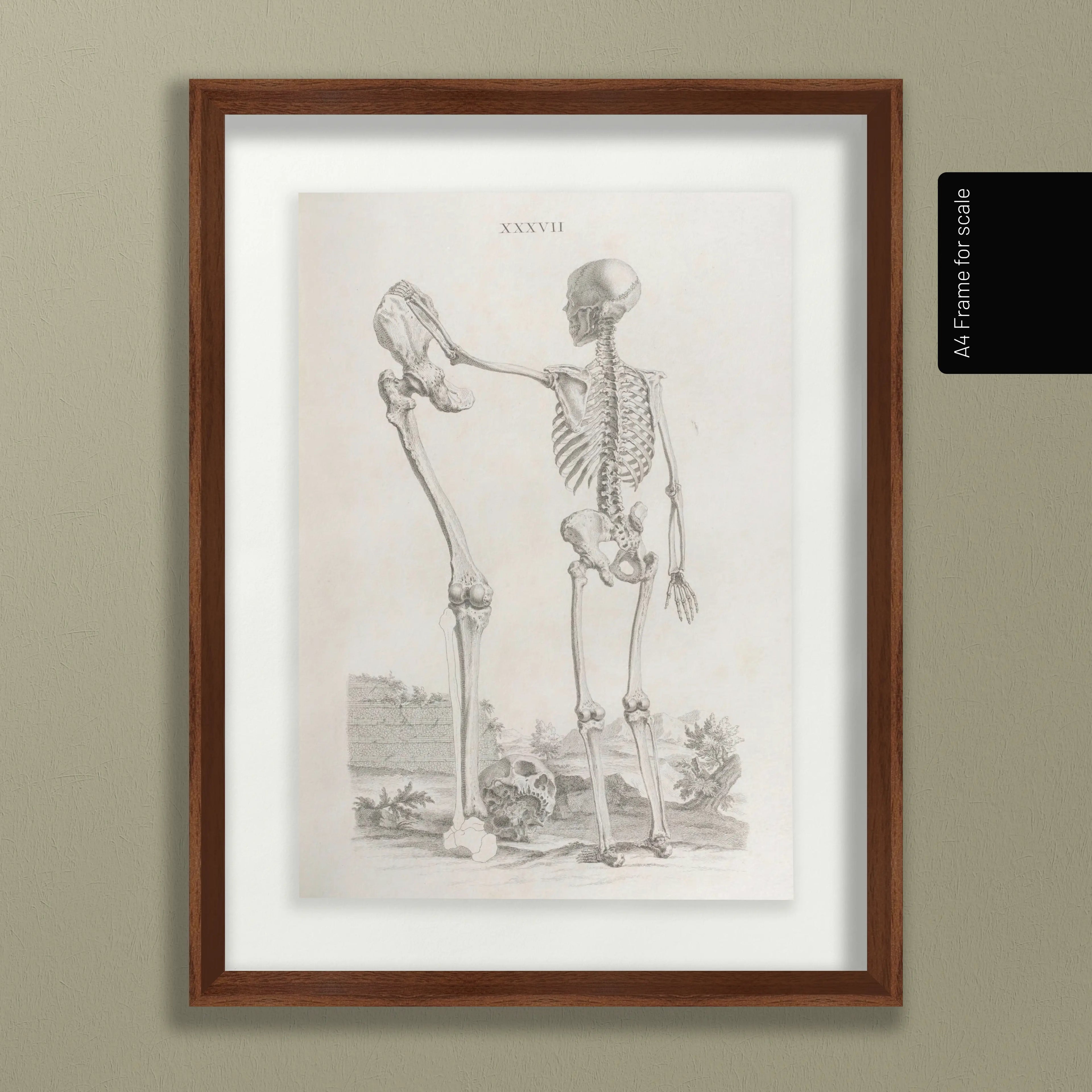 Anatomy: Plate No. 31