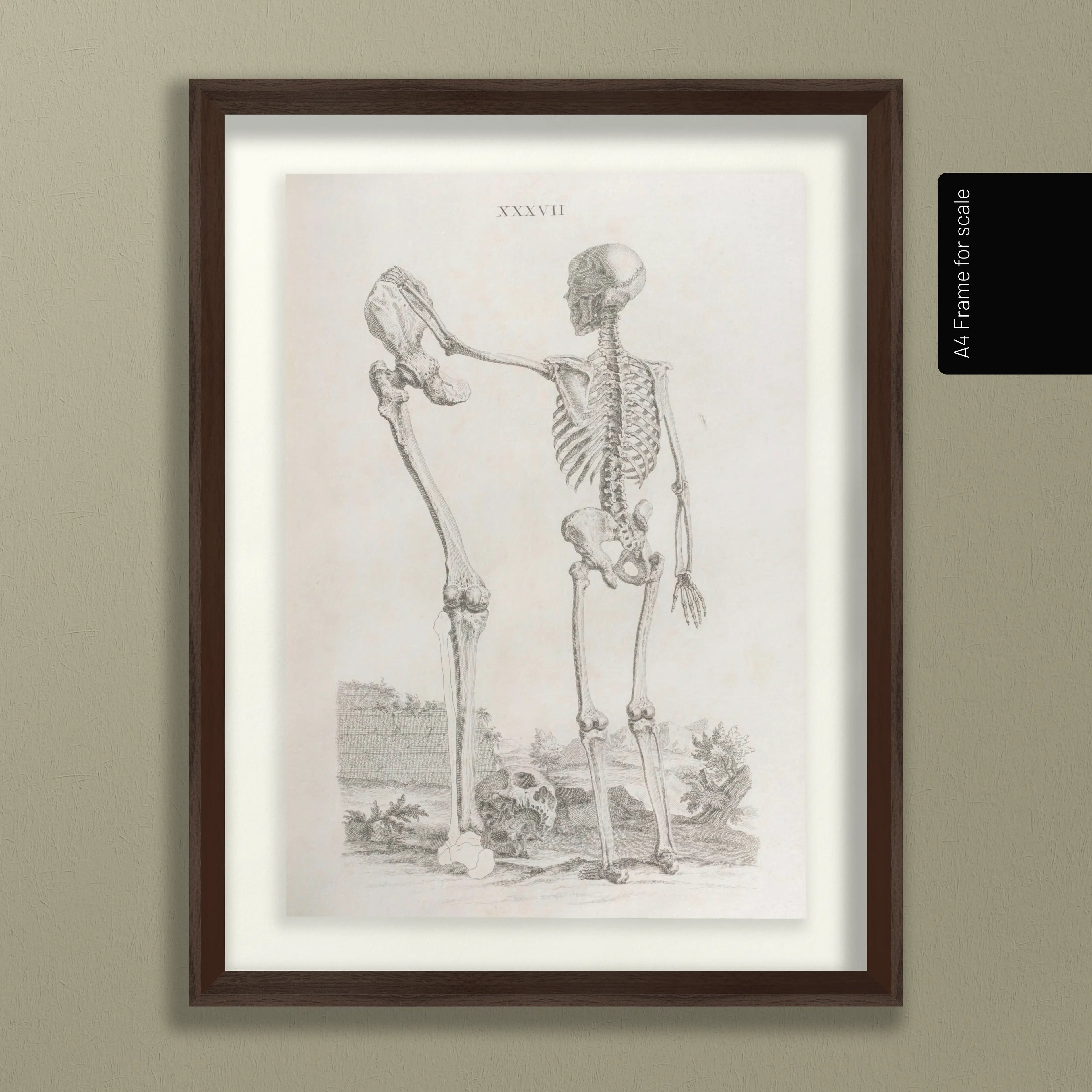 Anatomy: Plate No. 31