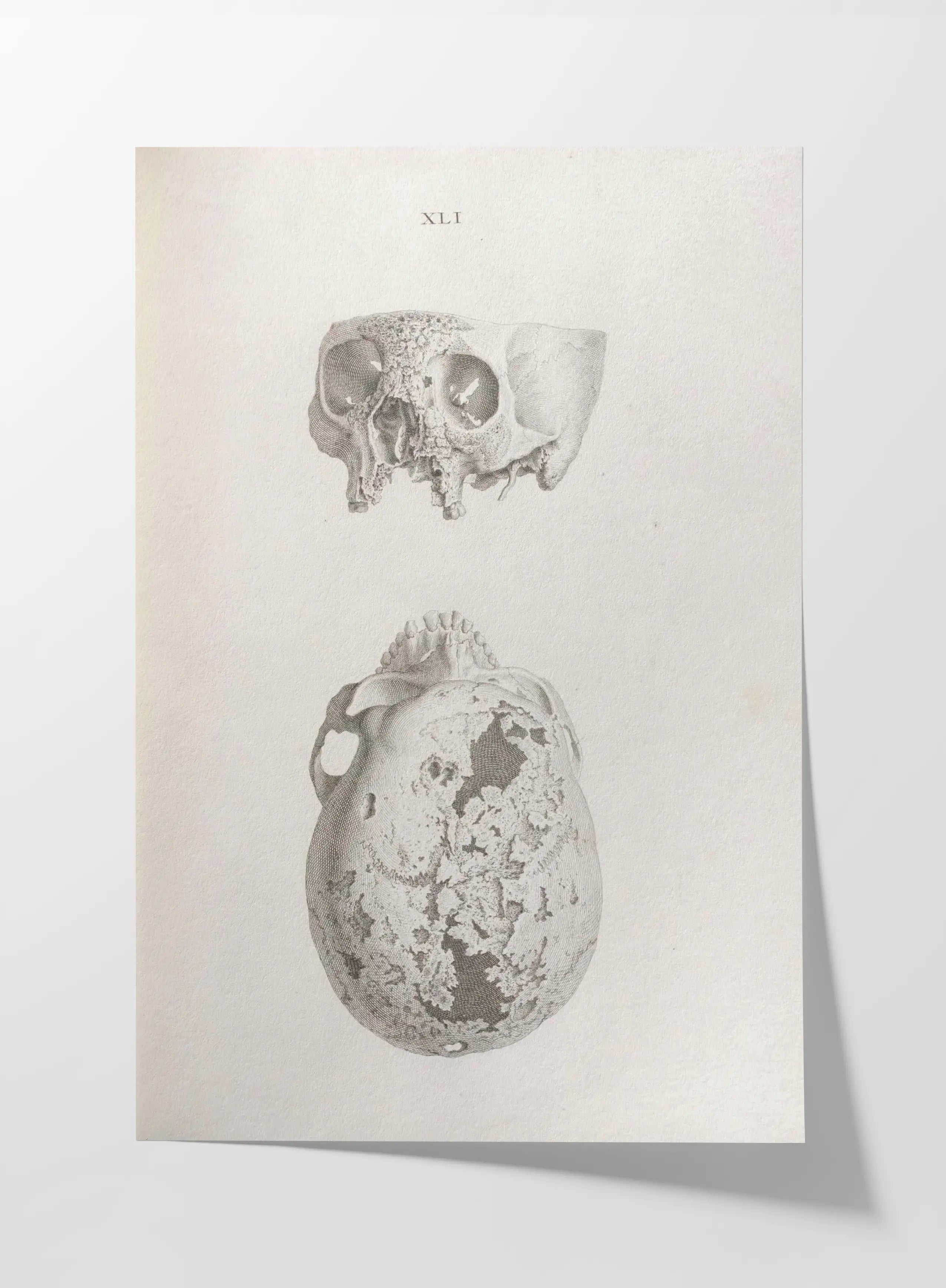 Anatomy: Plate No. 32