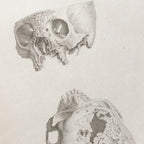 Anatomy: Plate No. 32