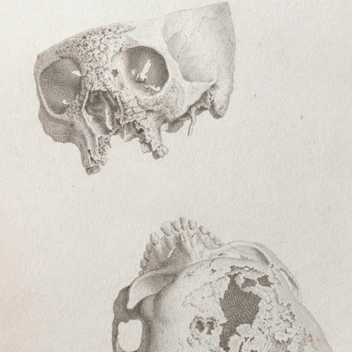 Anatomy: Plate No. 32