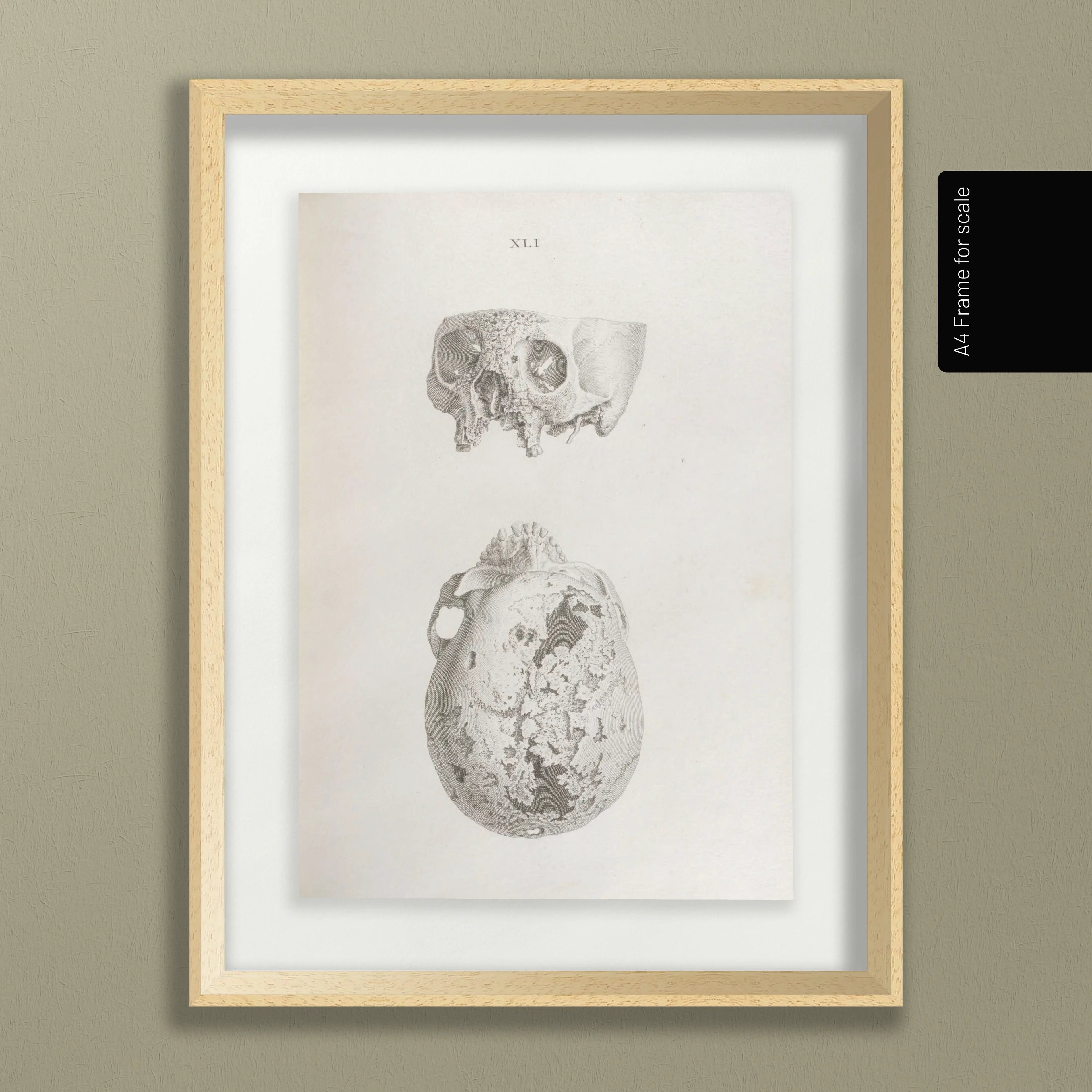 Anatomy: Plate No. 32