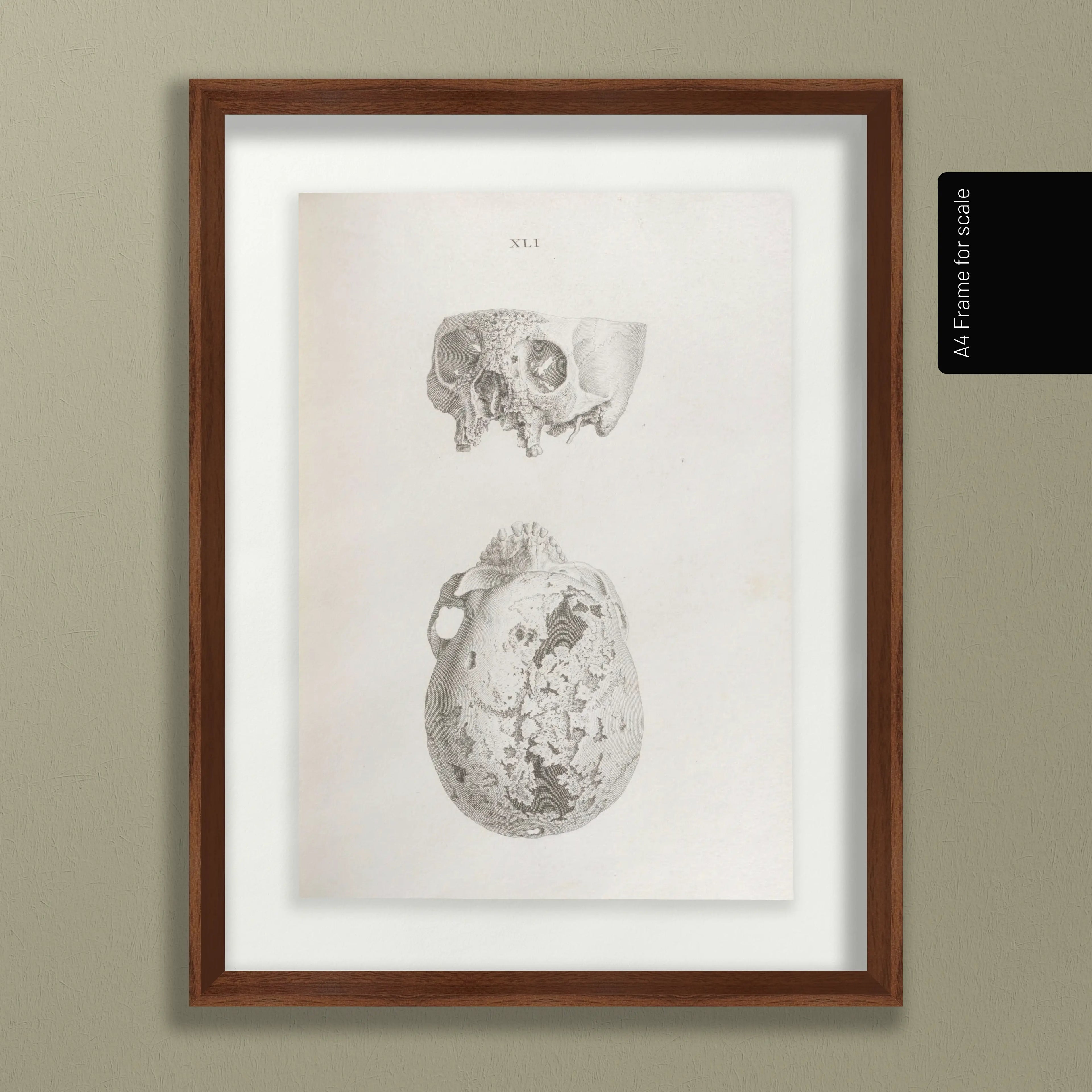Anatomy: Plate No. 32