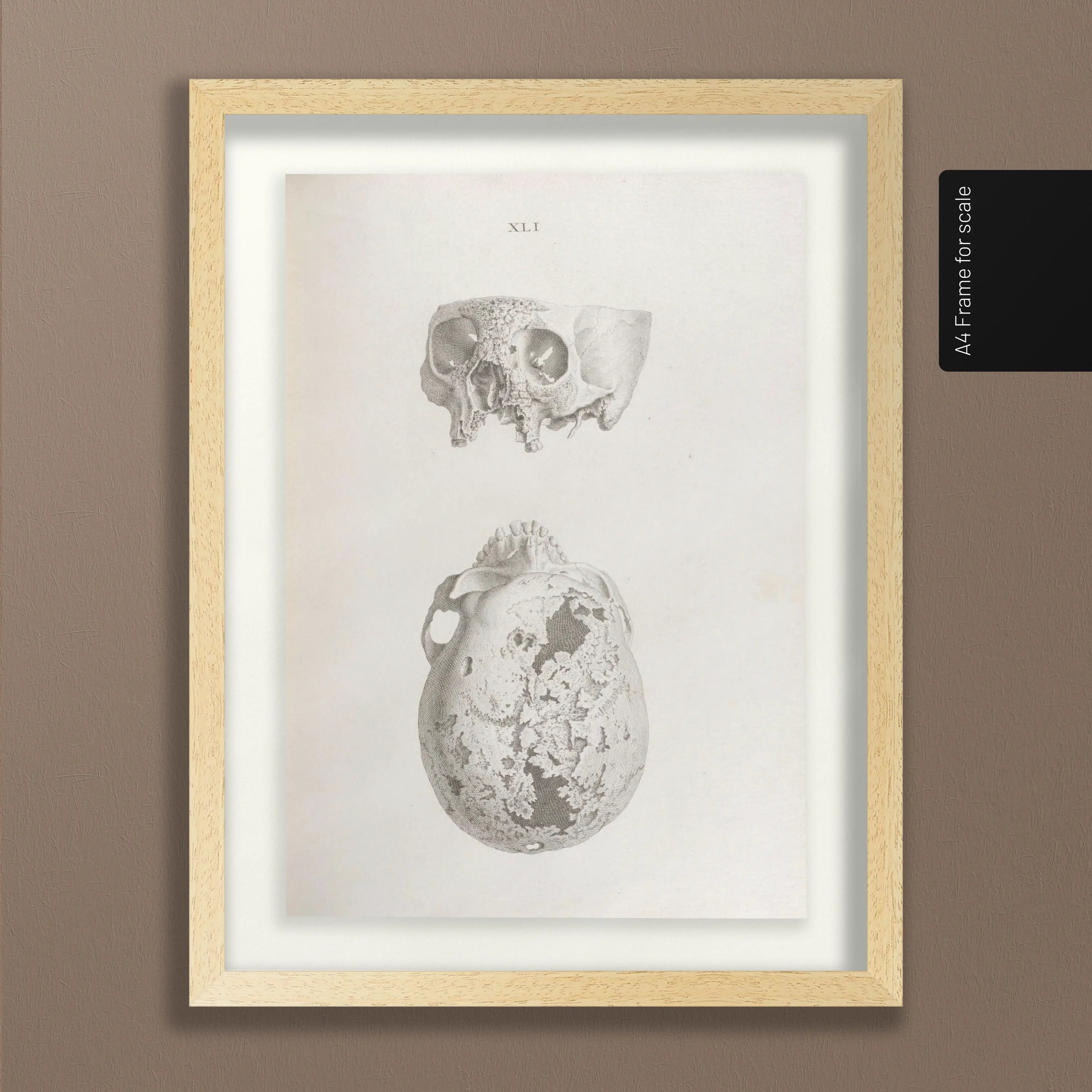 Anatomy: Plate No. 32