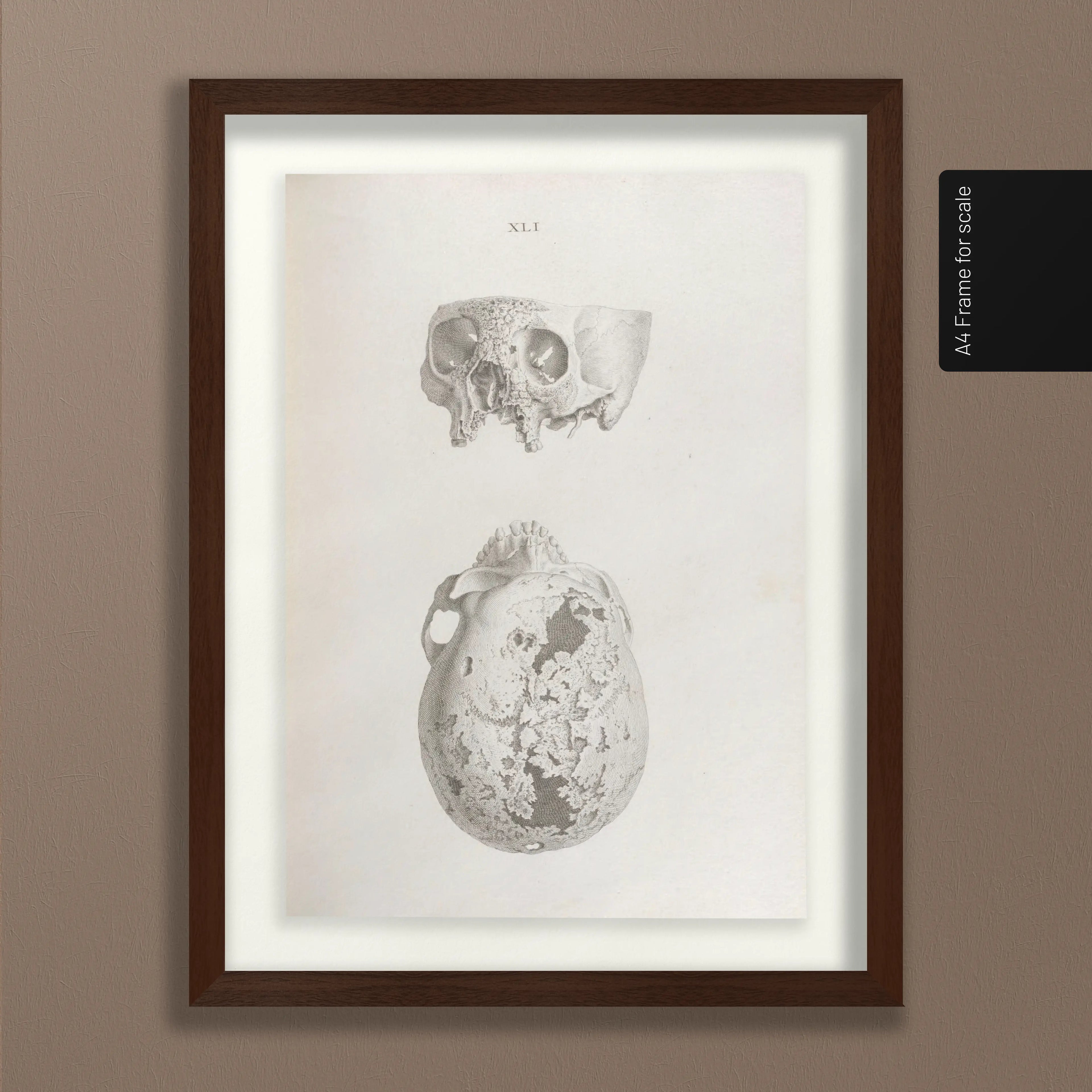 Anatomy: Plate No. 32
