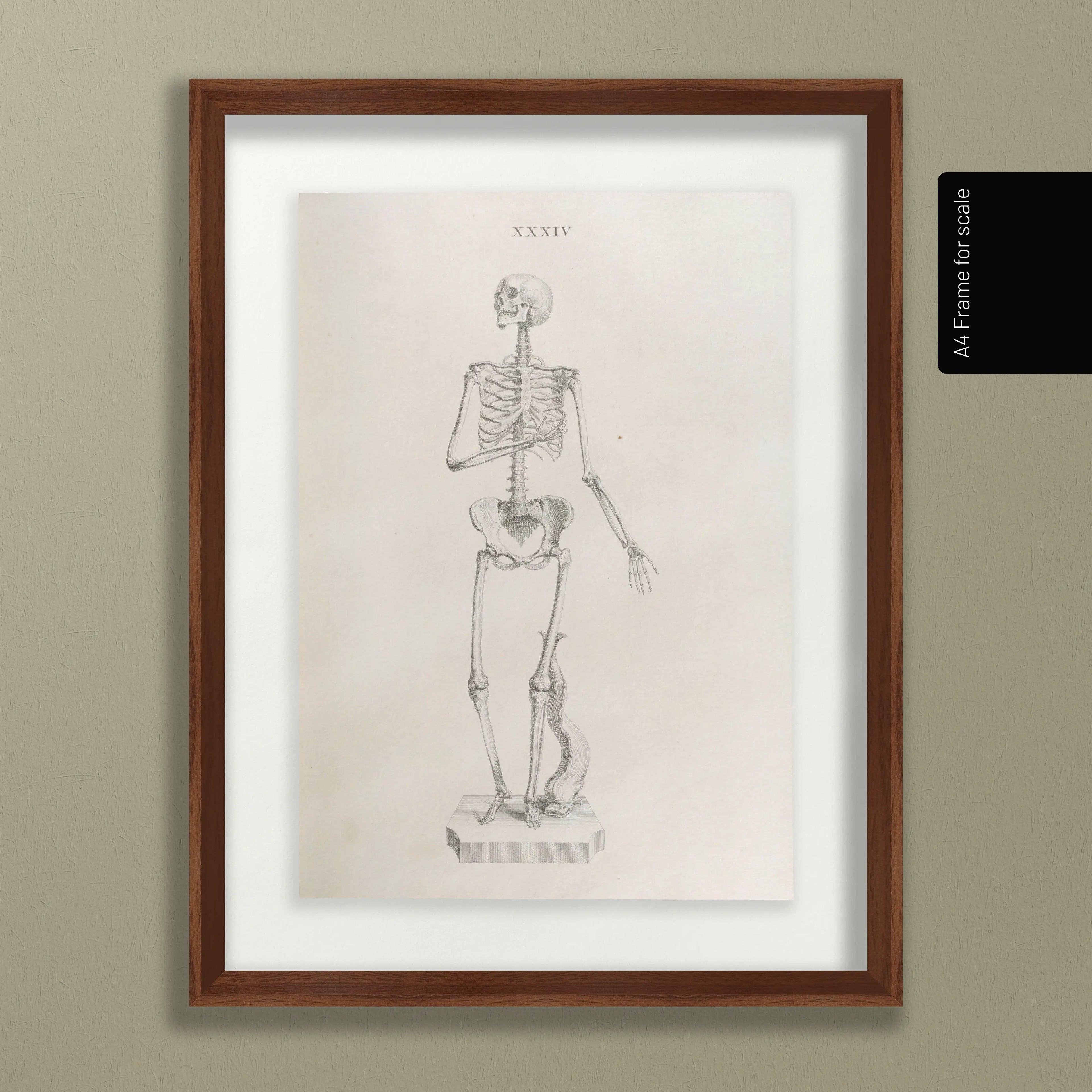 Anatomy: Plate No. 34