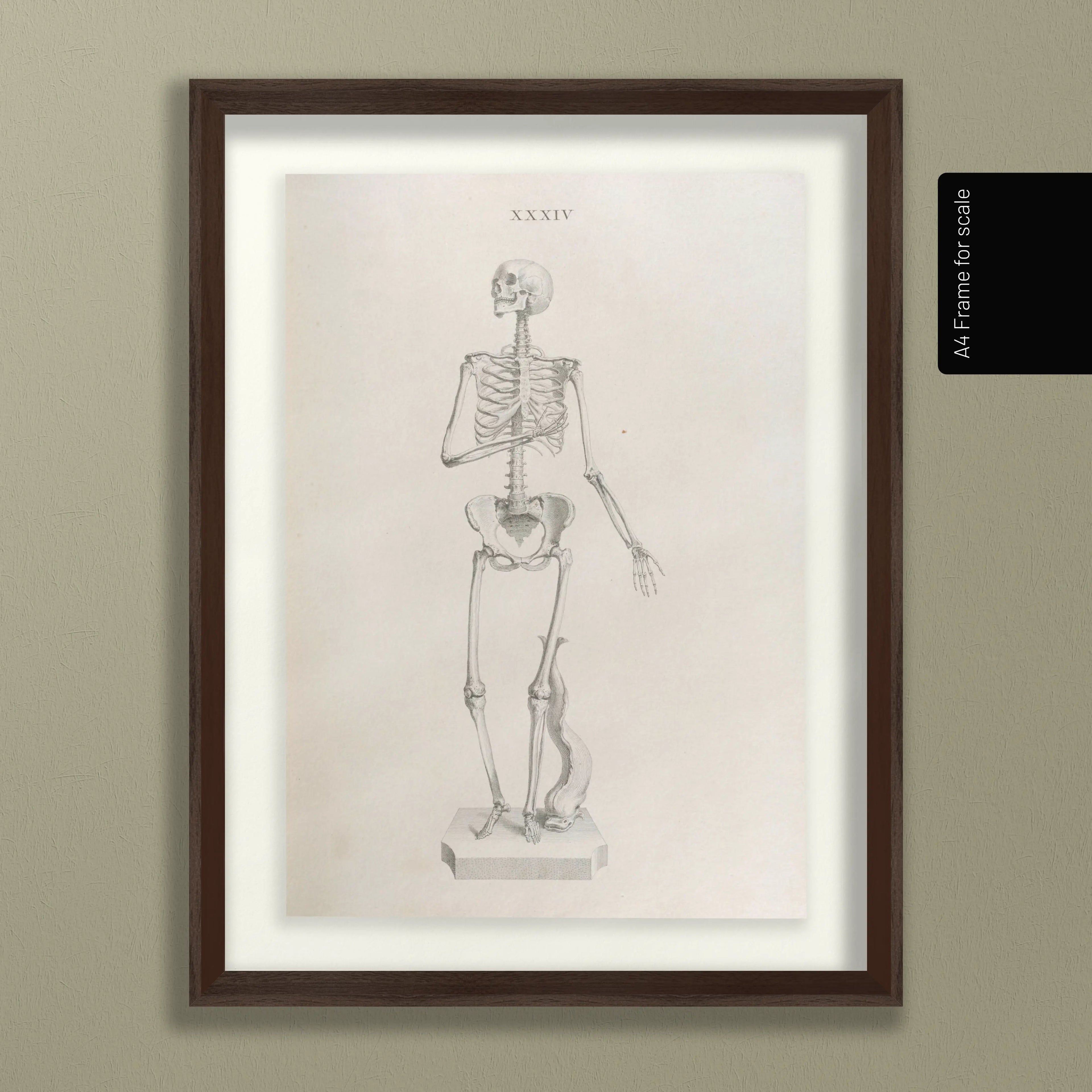 Anatomy: Plate No. 34