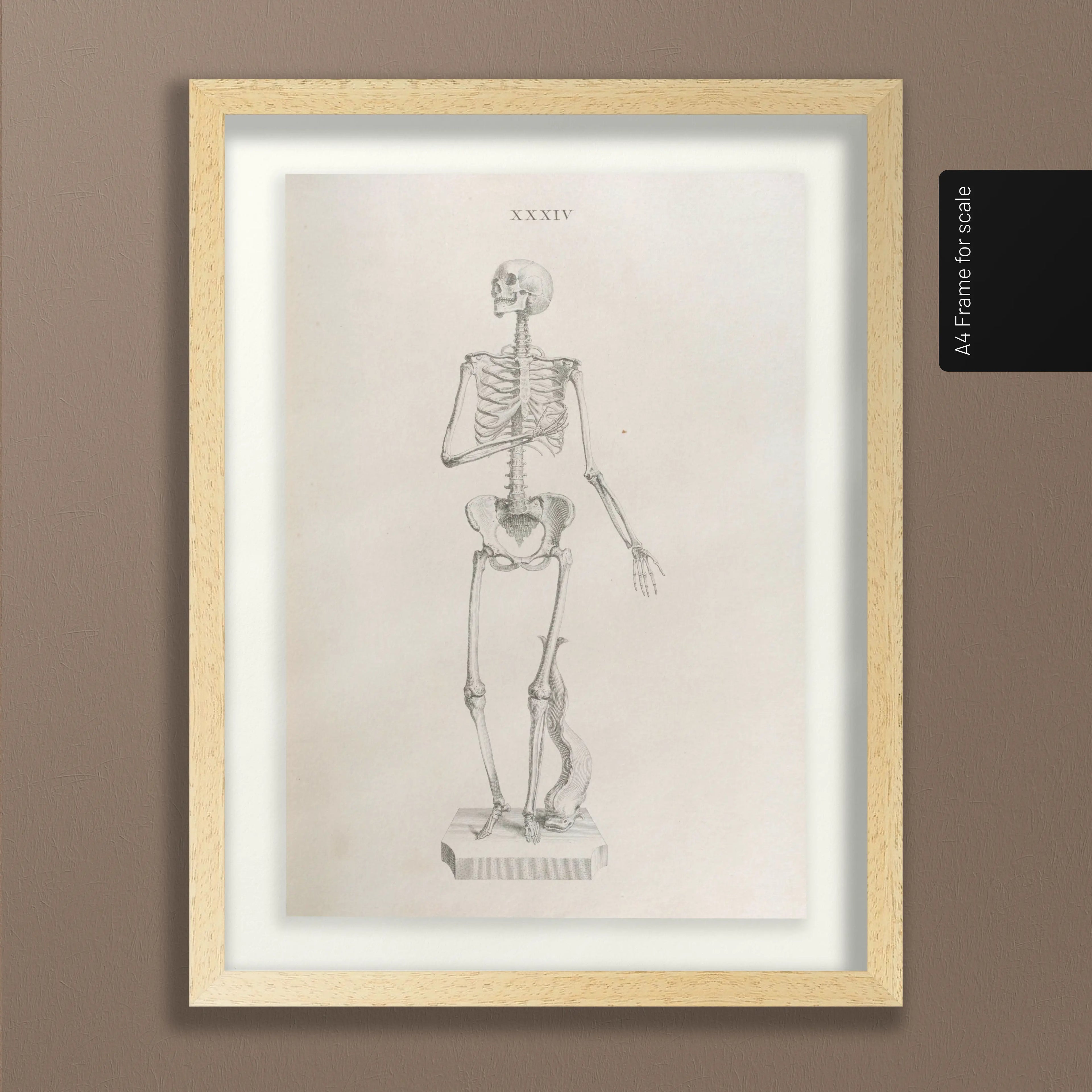 Anatomy: Plate No. 34