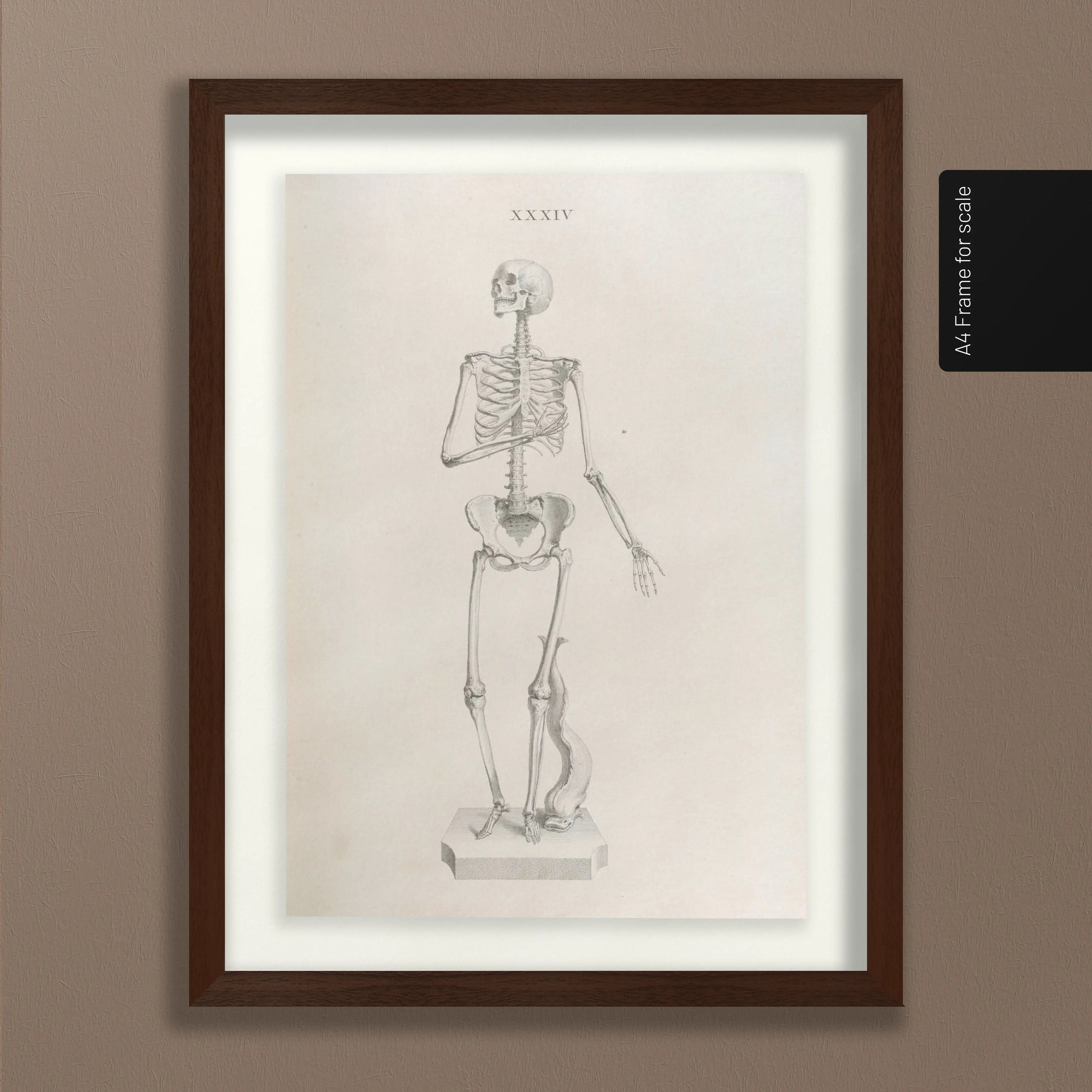 Anatomy: Plate No. 34