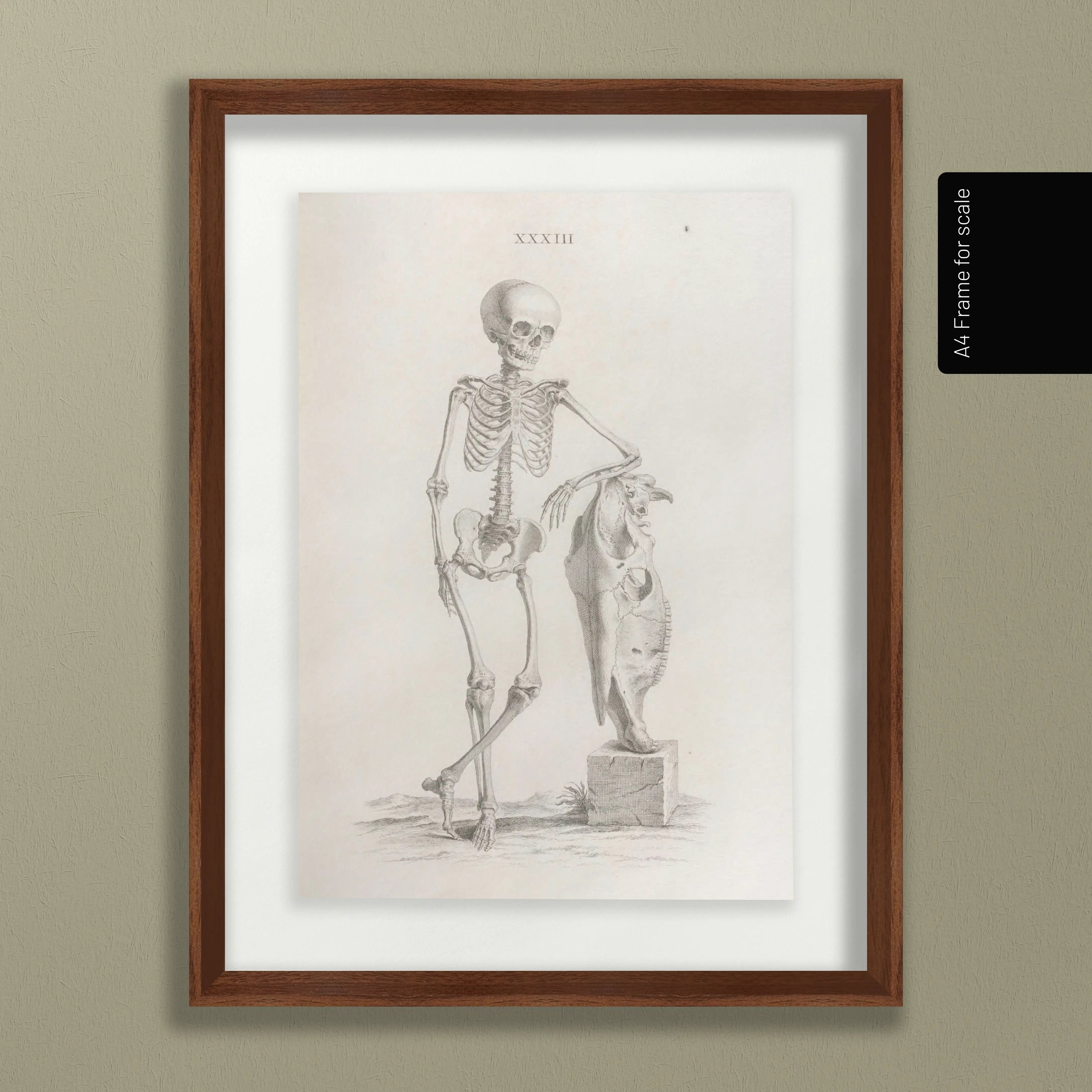 Anatomy: Plate No. 35