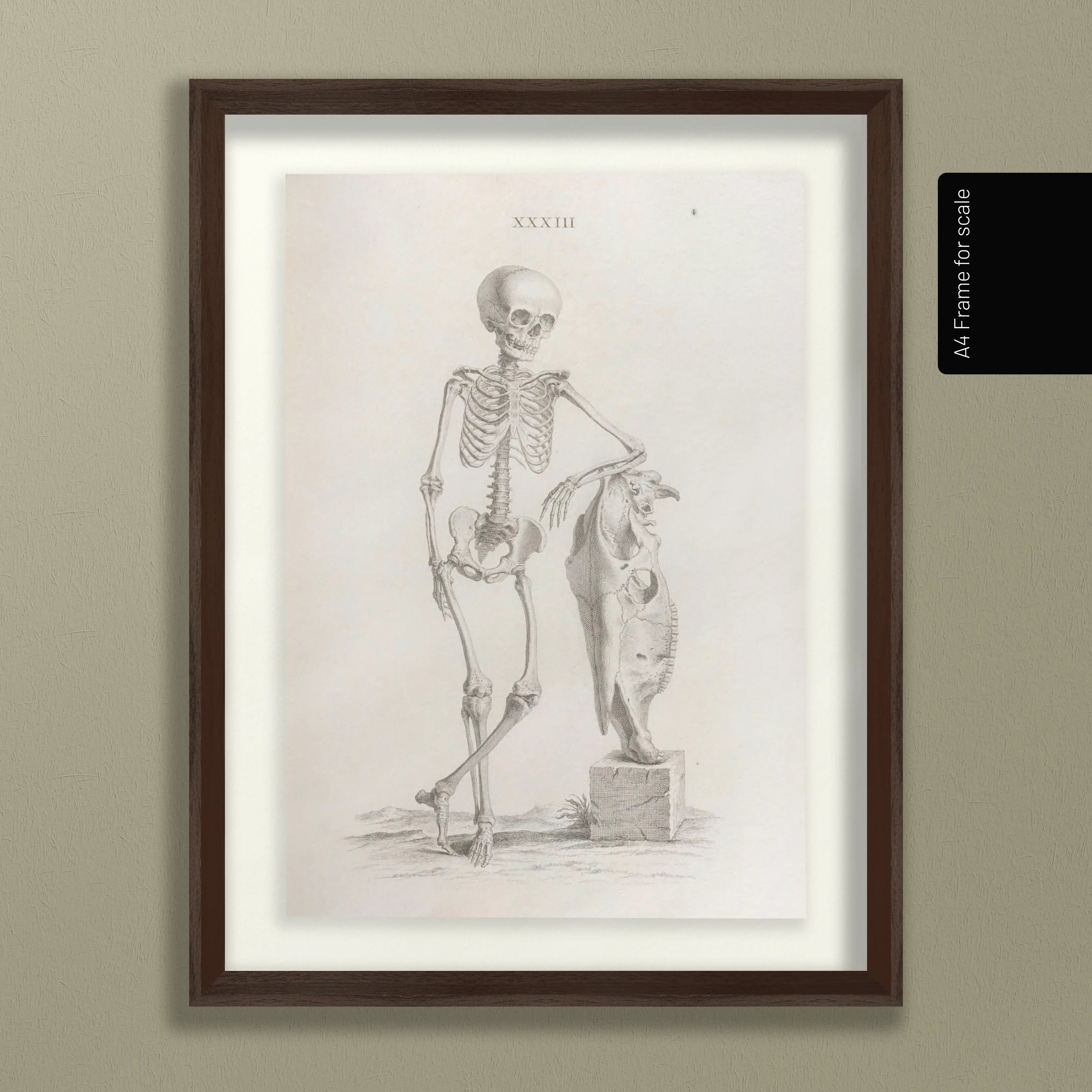 Anatomy: Plate No. 35