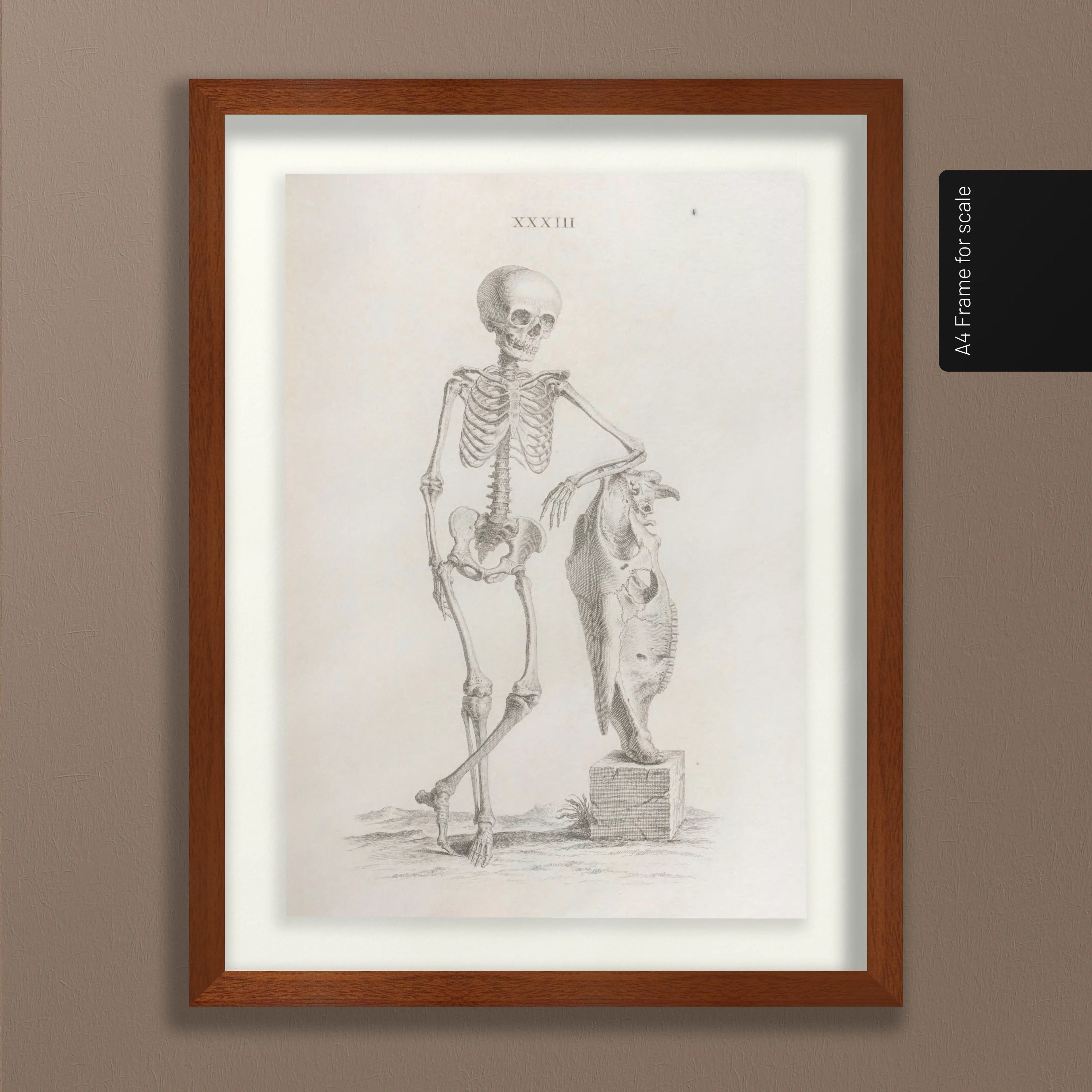 Anatomy: Plate No. 35