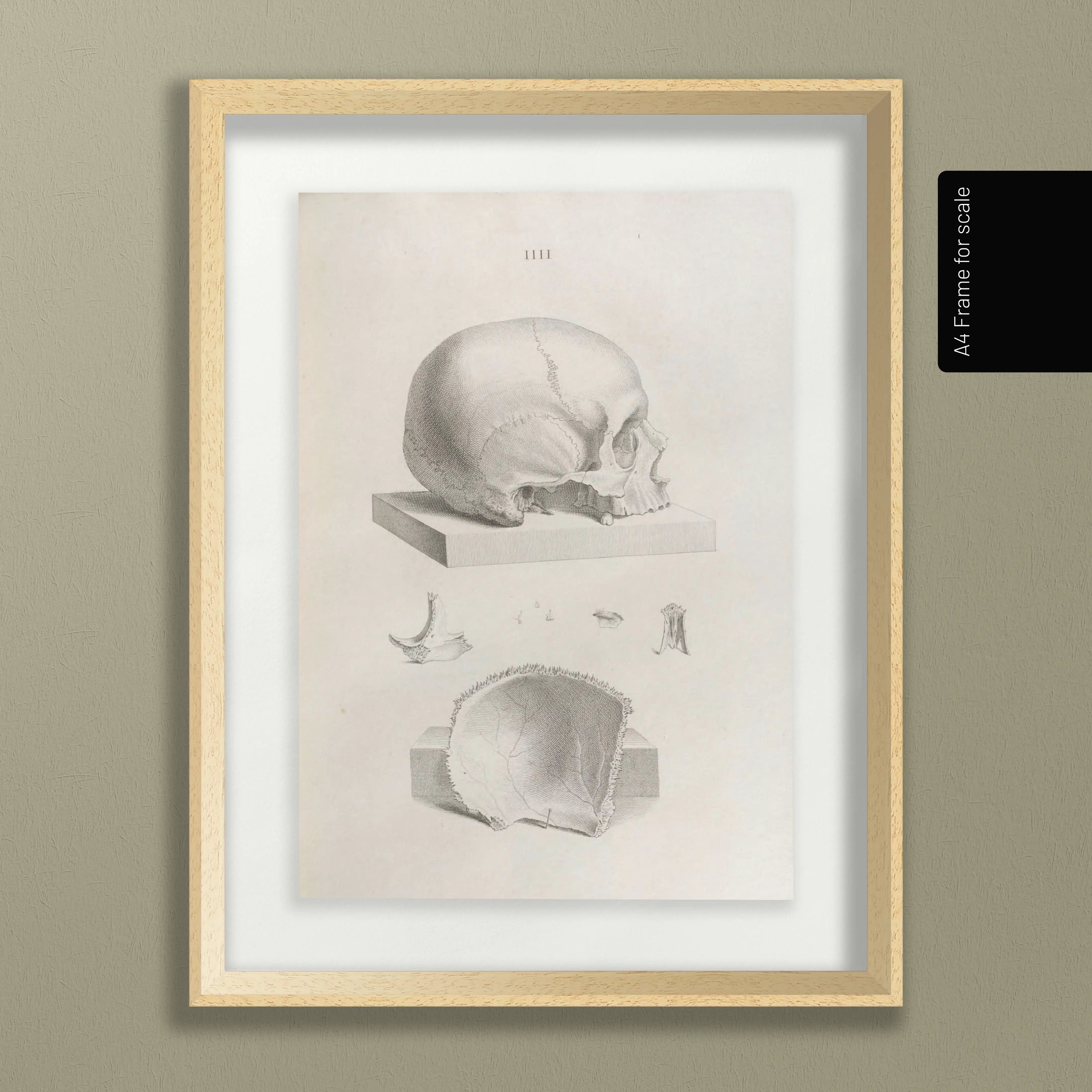 Anatomy: Plate No. 39
