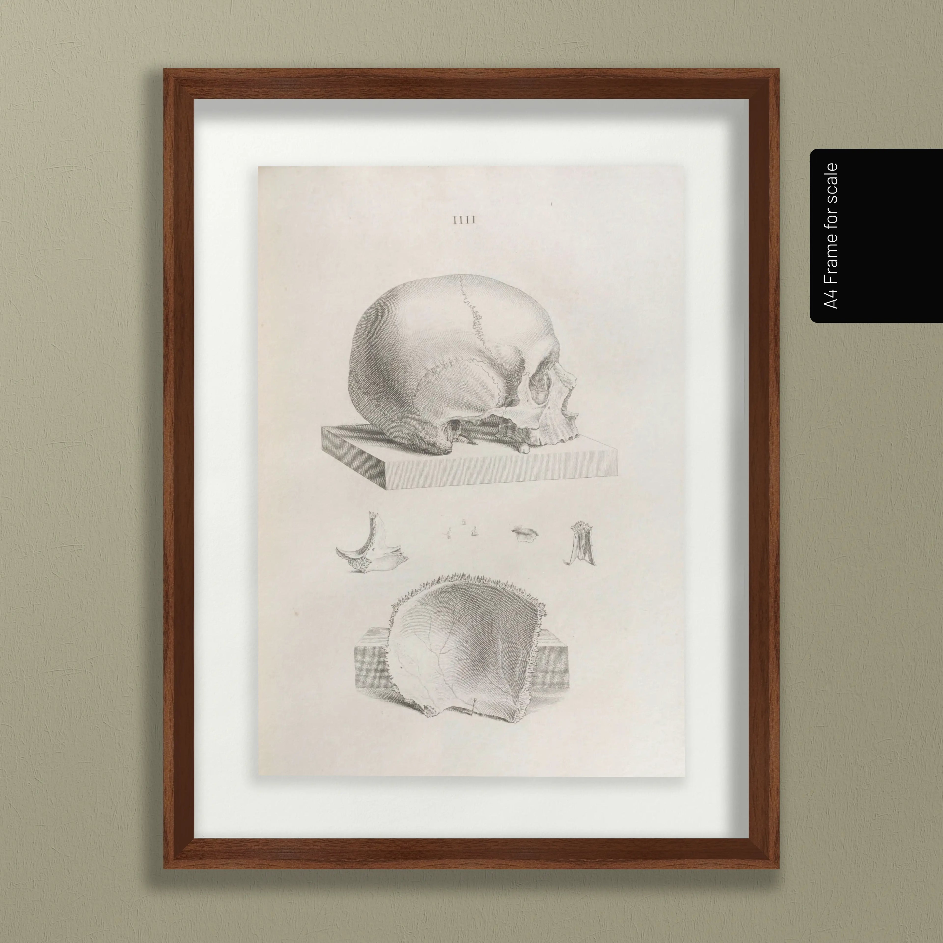 Anatomy: Plate No. 39