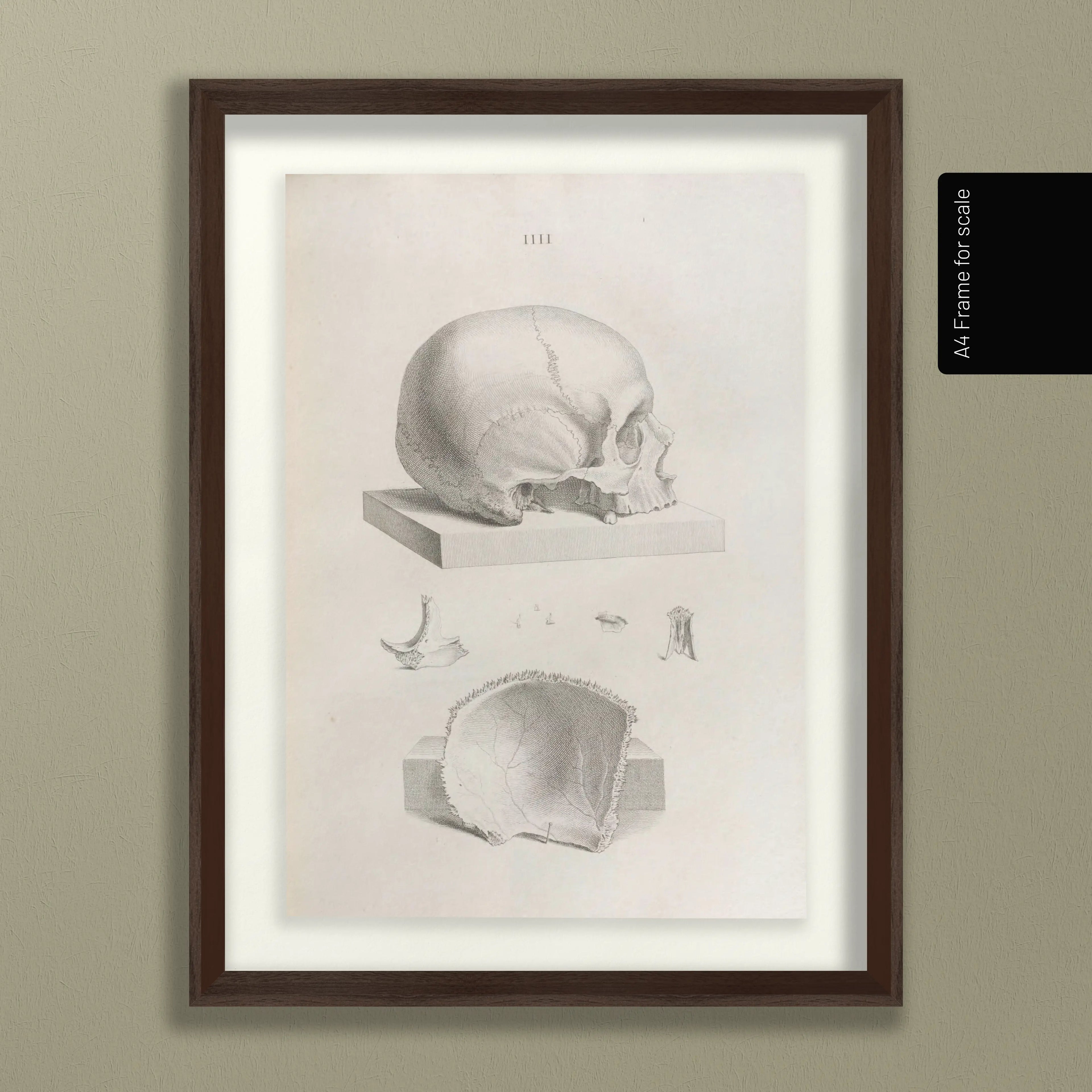 Anatomy: Plate No. 39