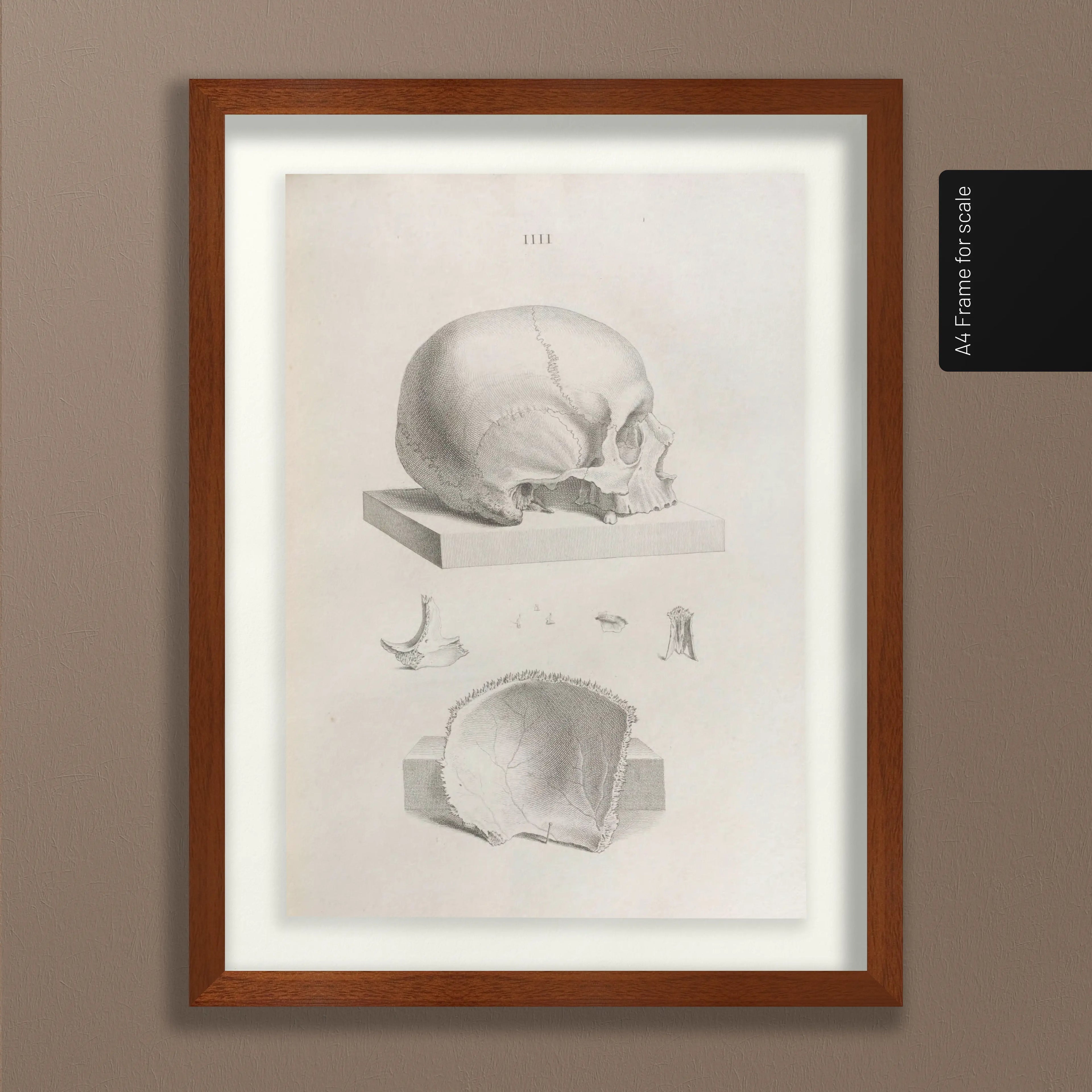 Anatomy: Plate No. 39