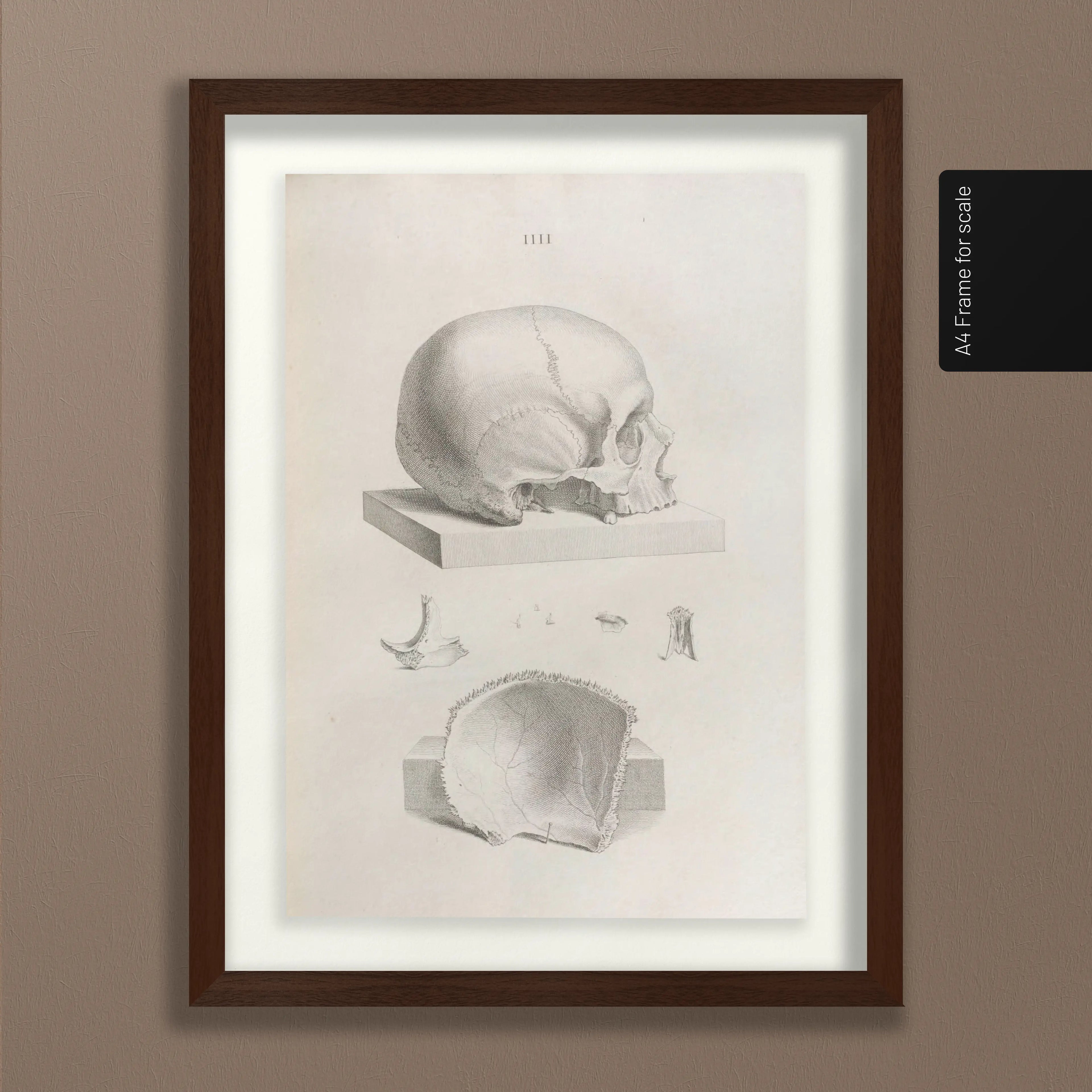 Anatomy: Plate No. 39
