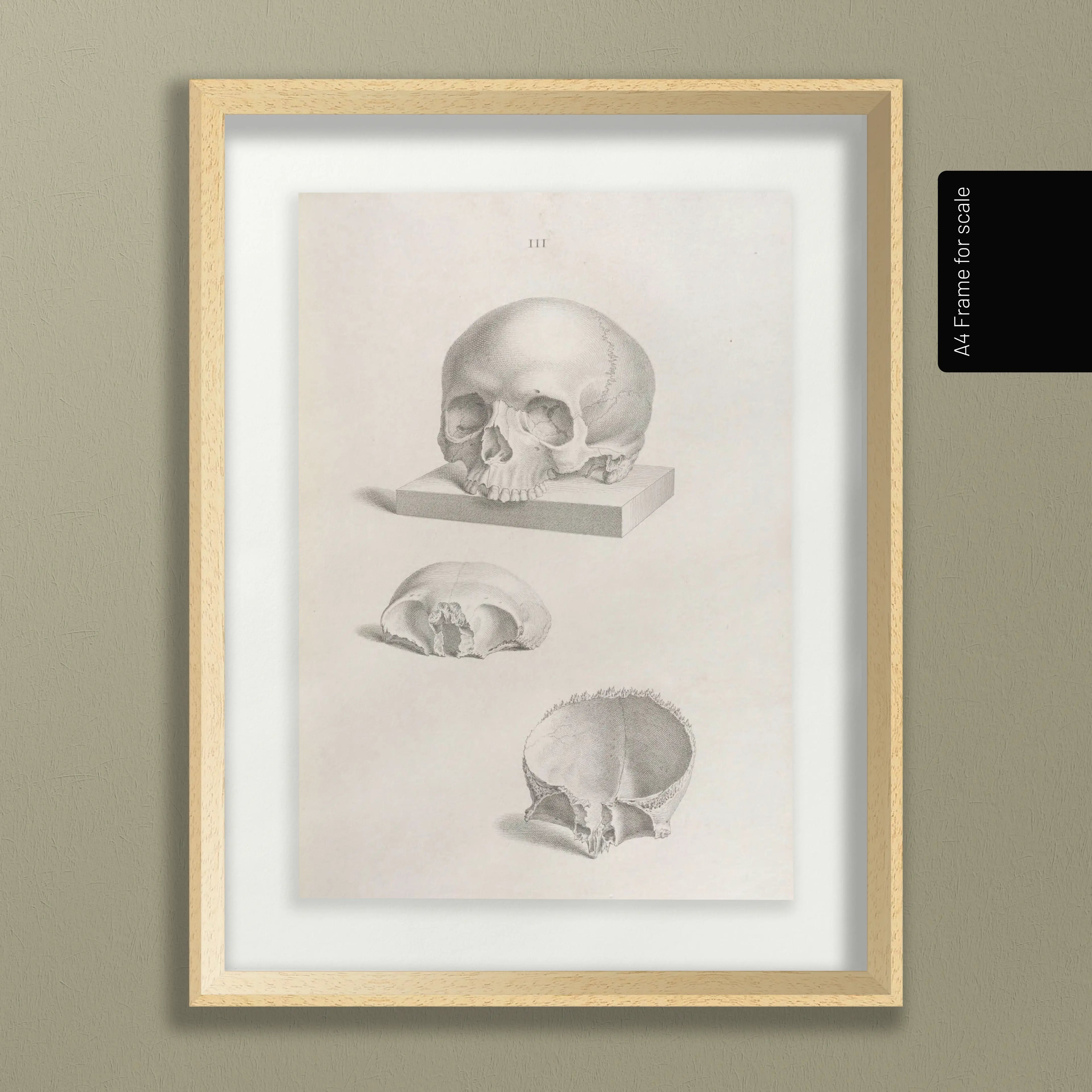 Anatomy: Plate No. 40