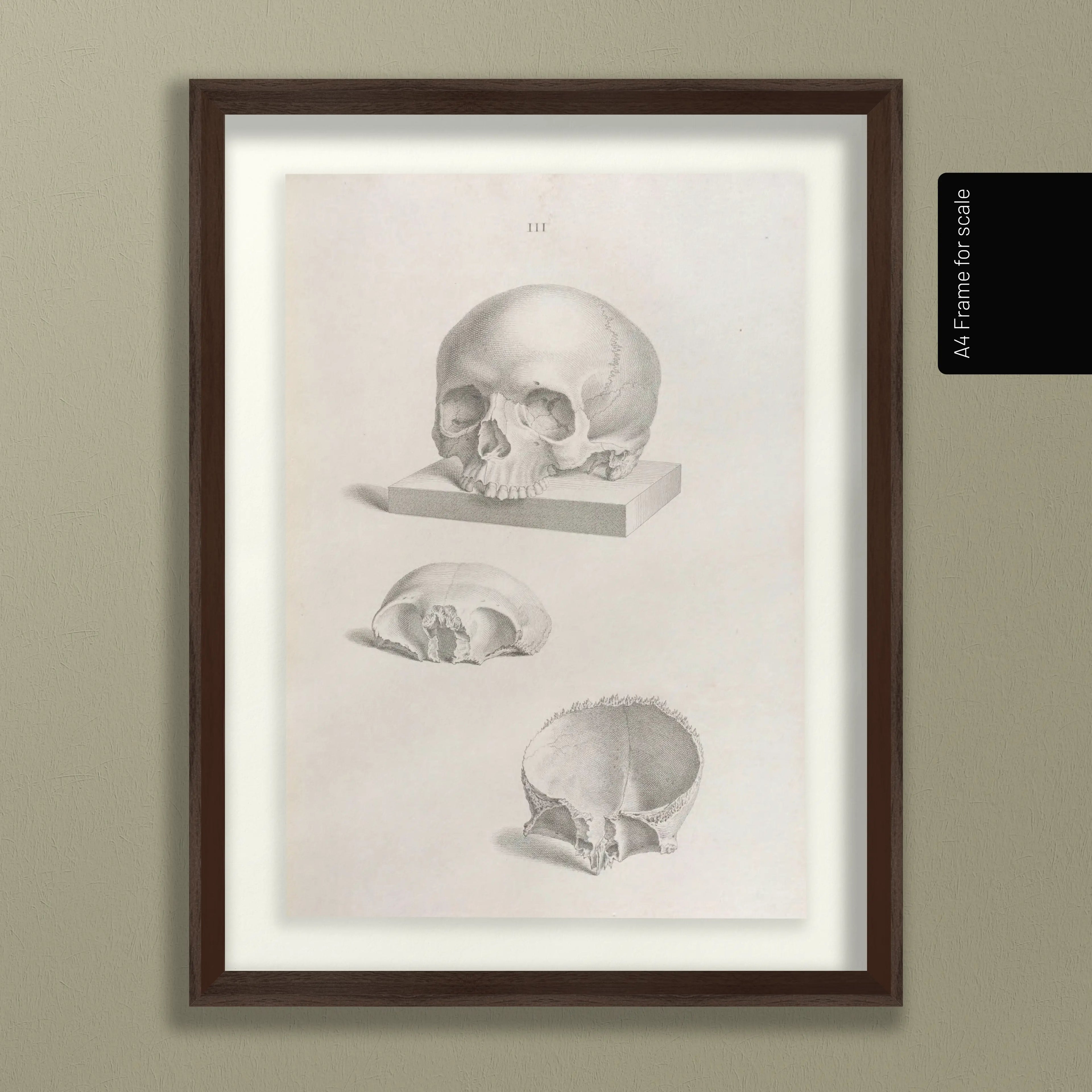 Anatomy: Plate No. 40