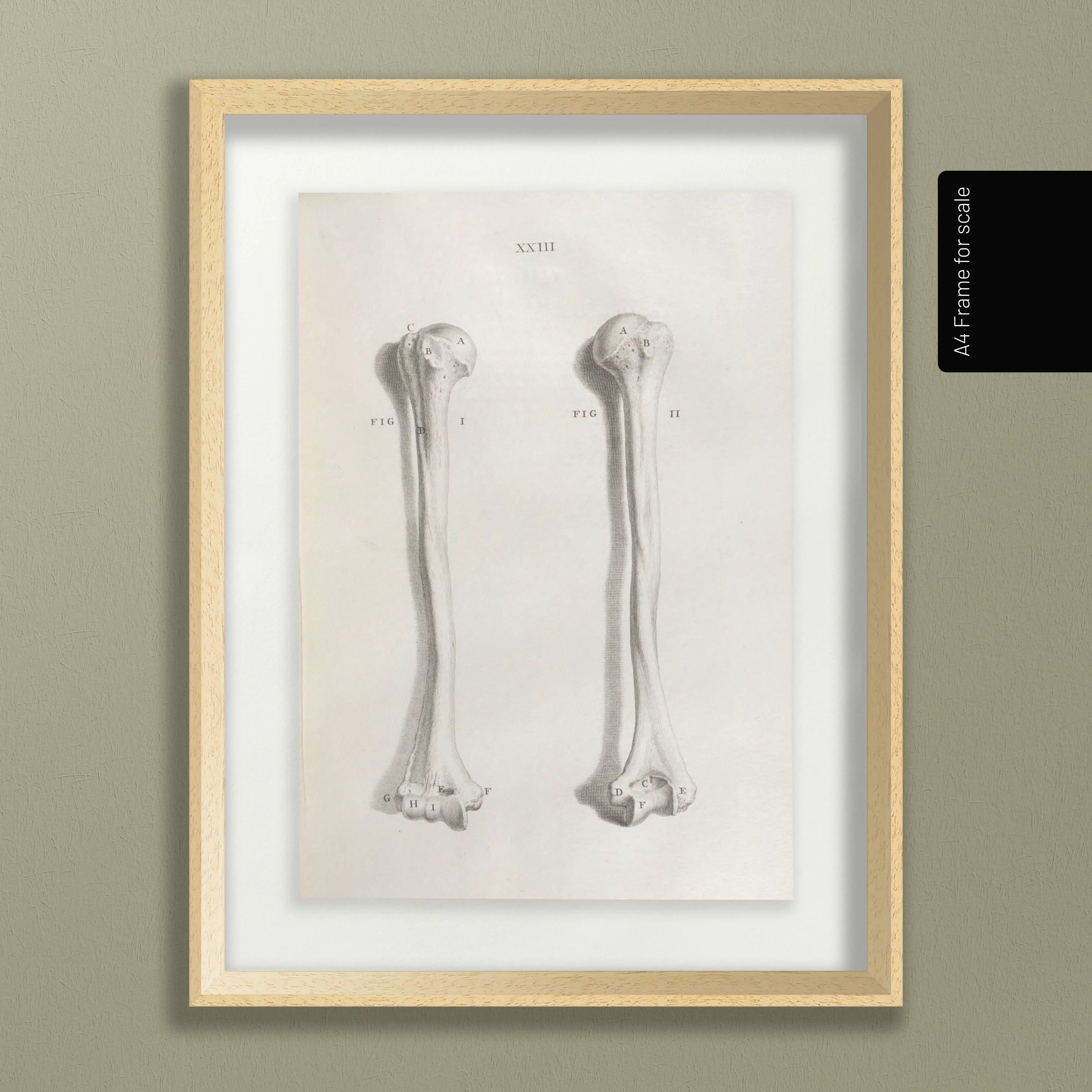 Anatomy: Plate No. 42