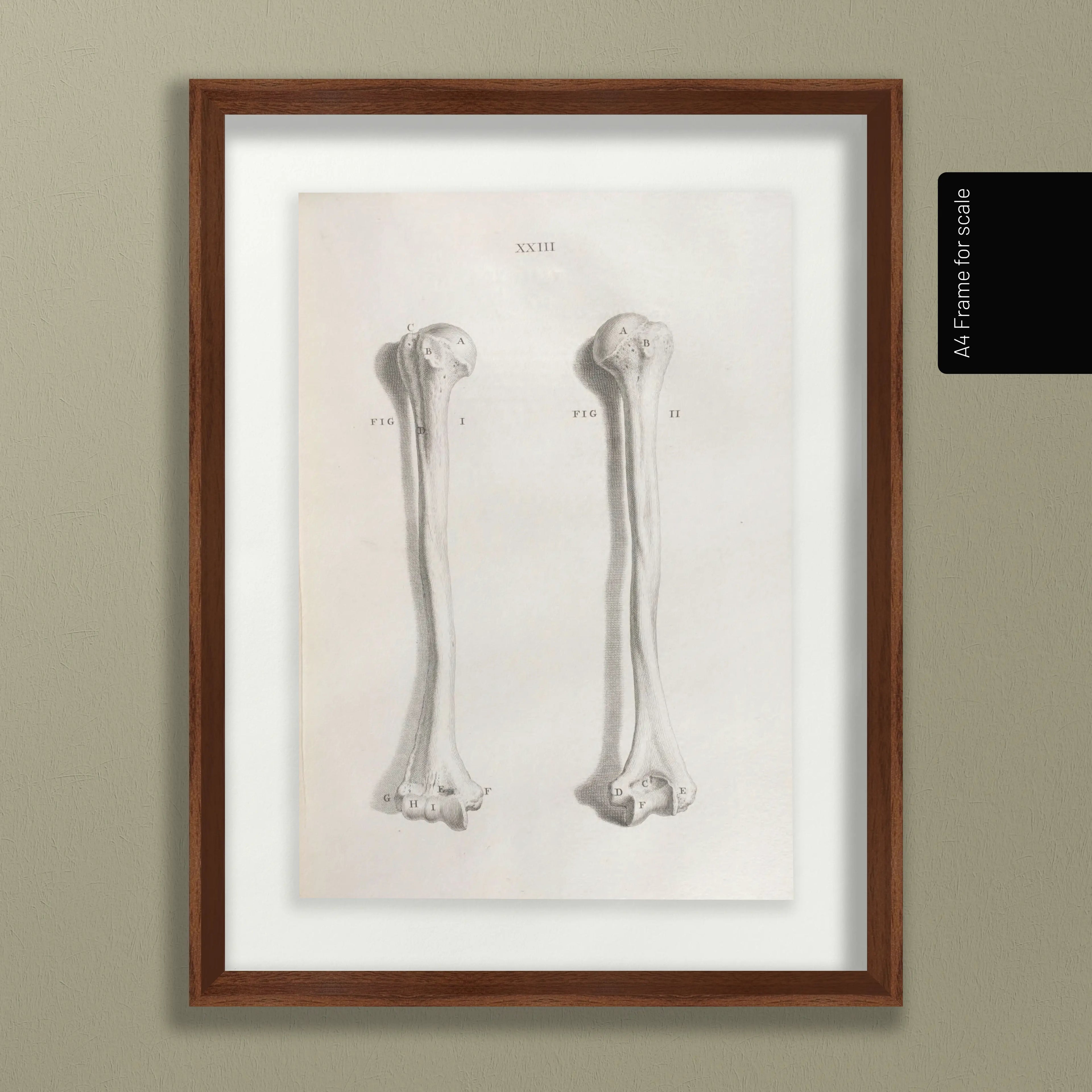 Anatomy: Plate No. 42