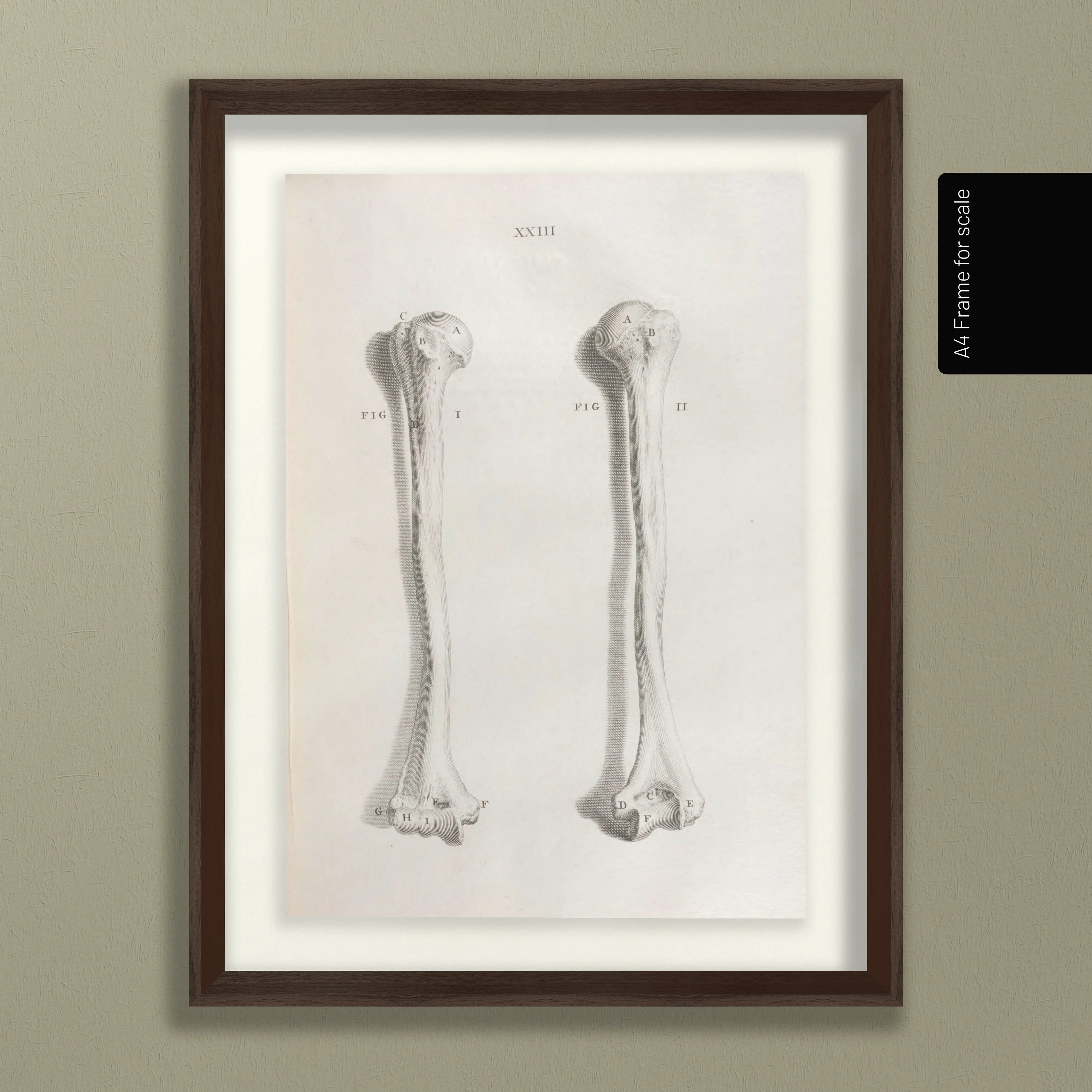 Anatomy: Plate No. 42