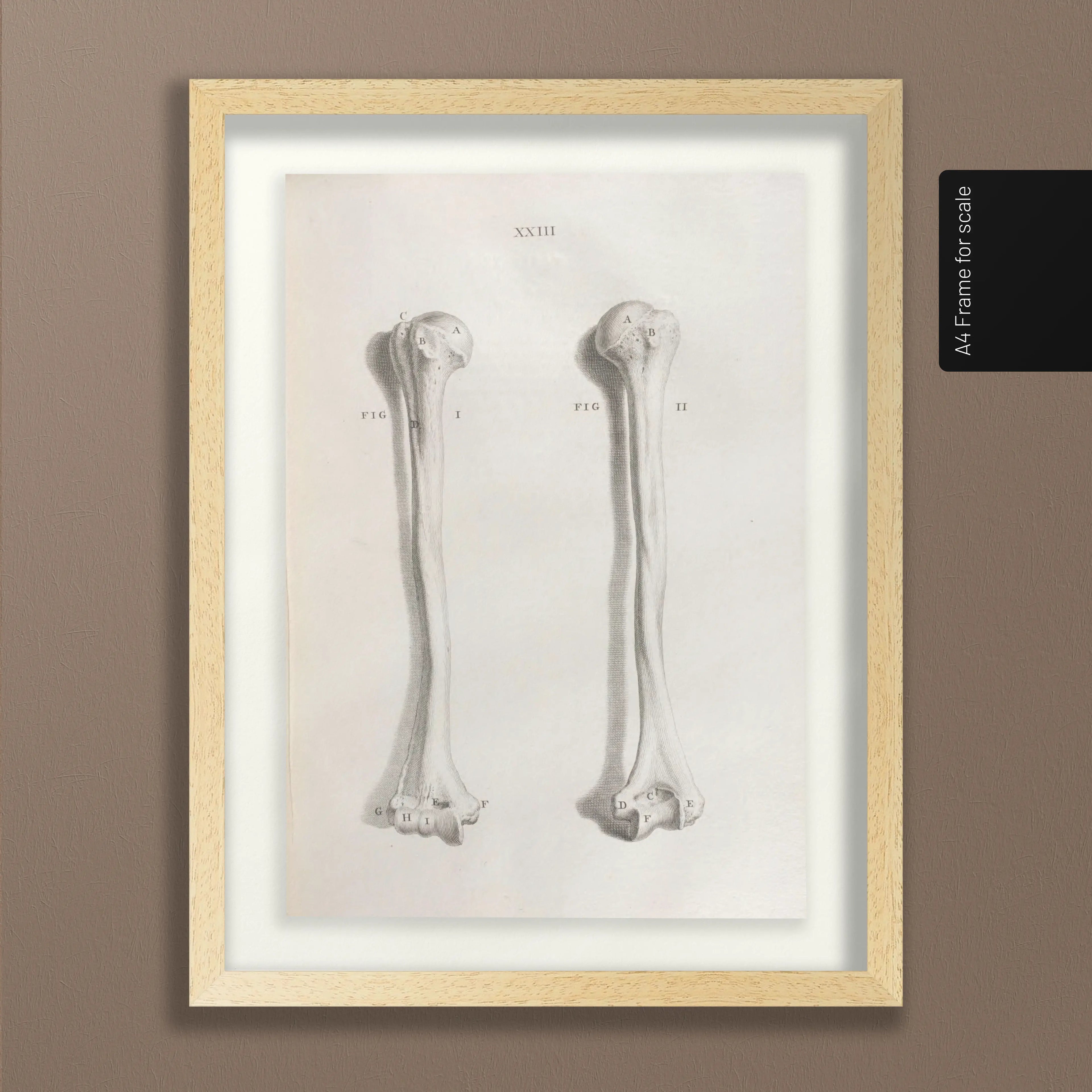 Anatomy: Plate No. 42