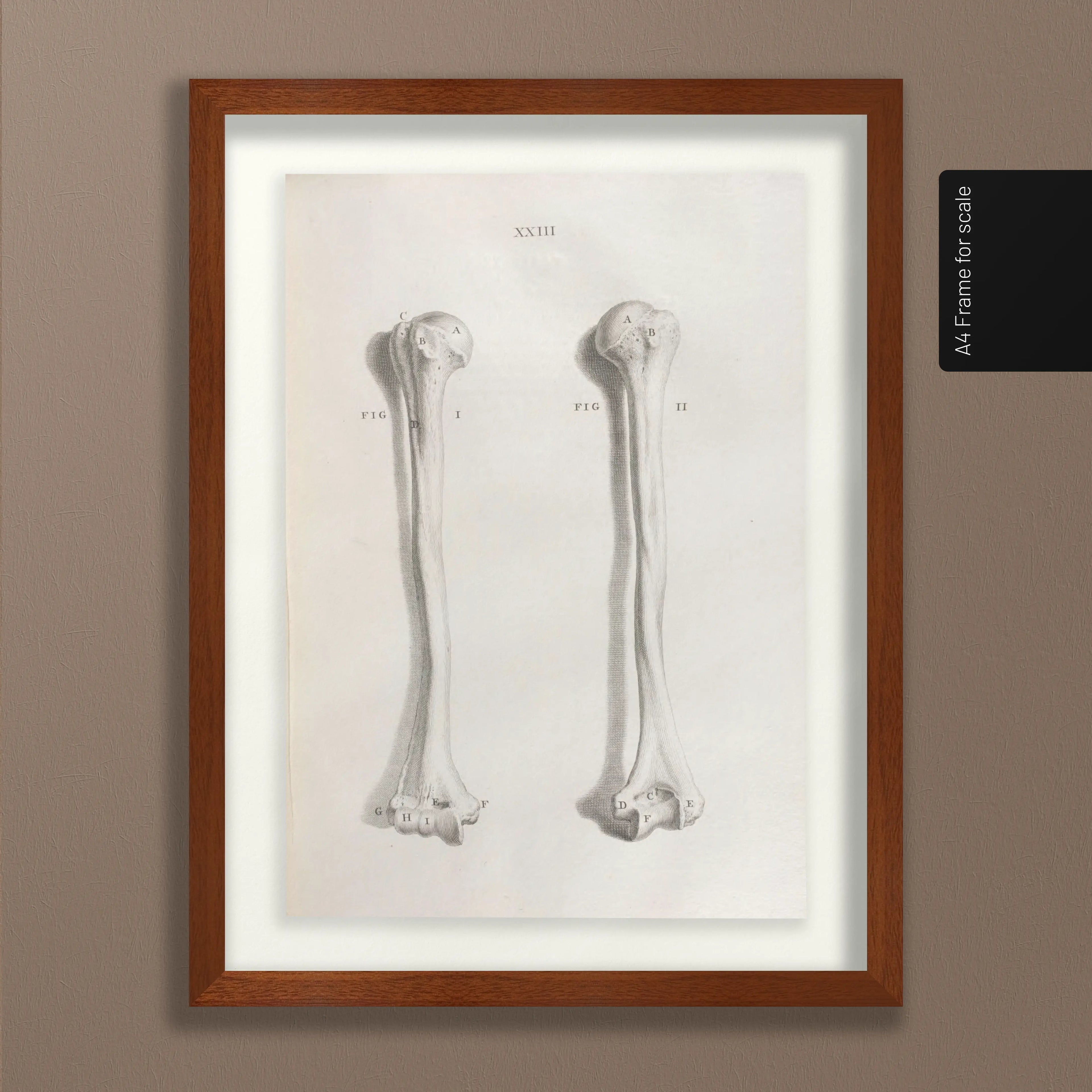 Anatomy: Plate No. 42