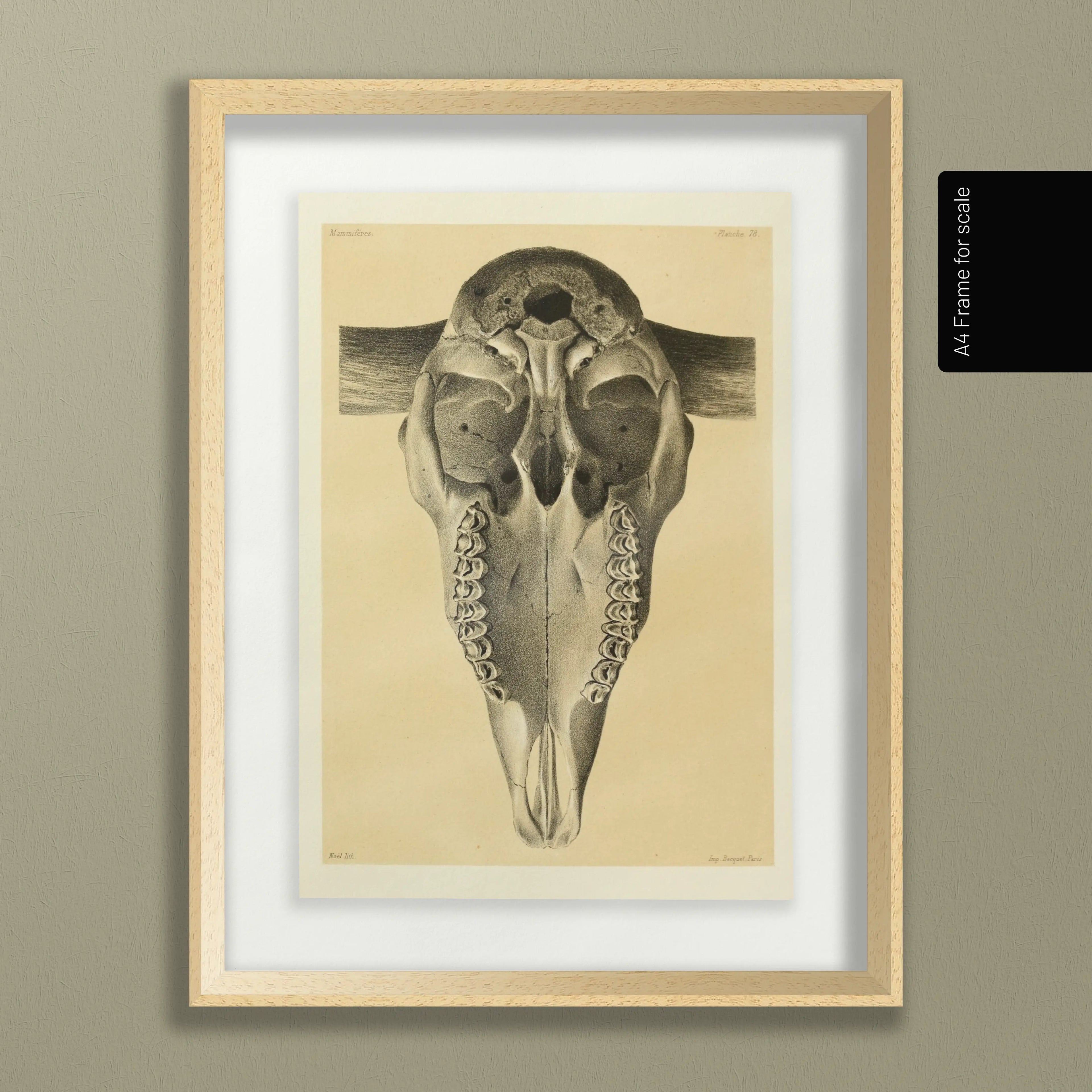 Anatomy: Plate No. 43