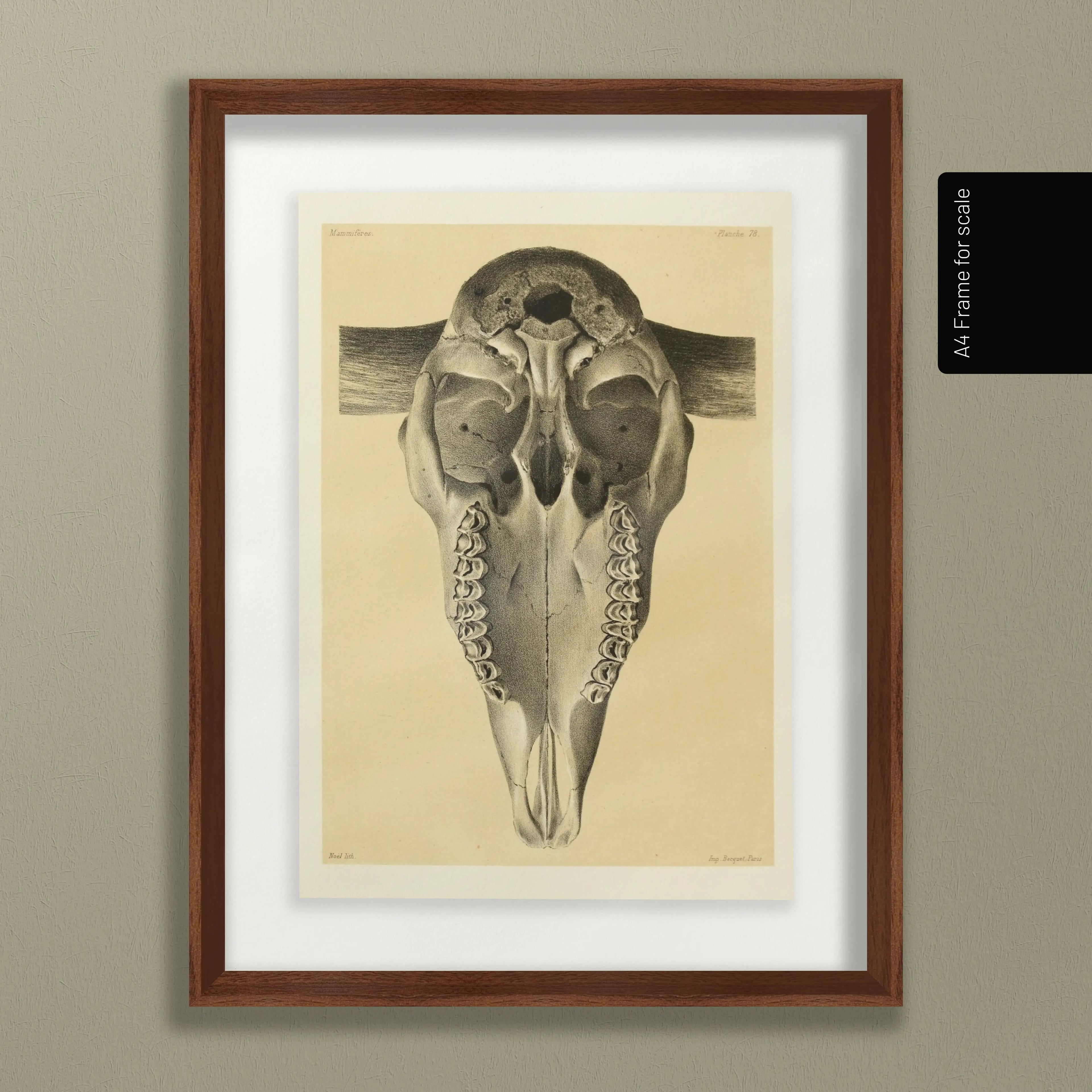 Anatomy: Plate No. 43