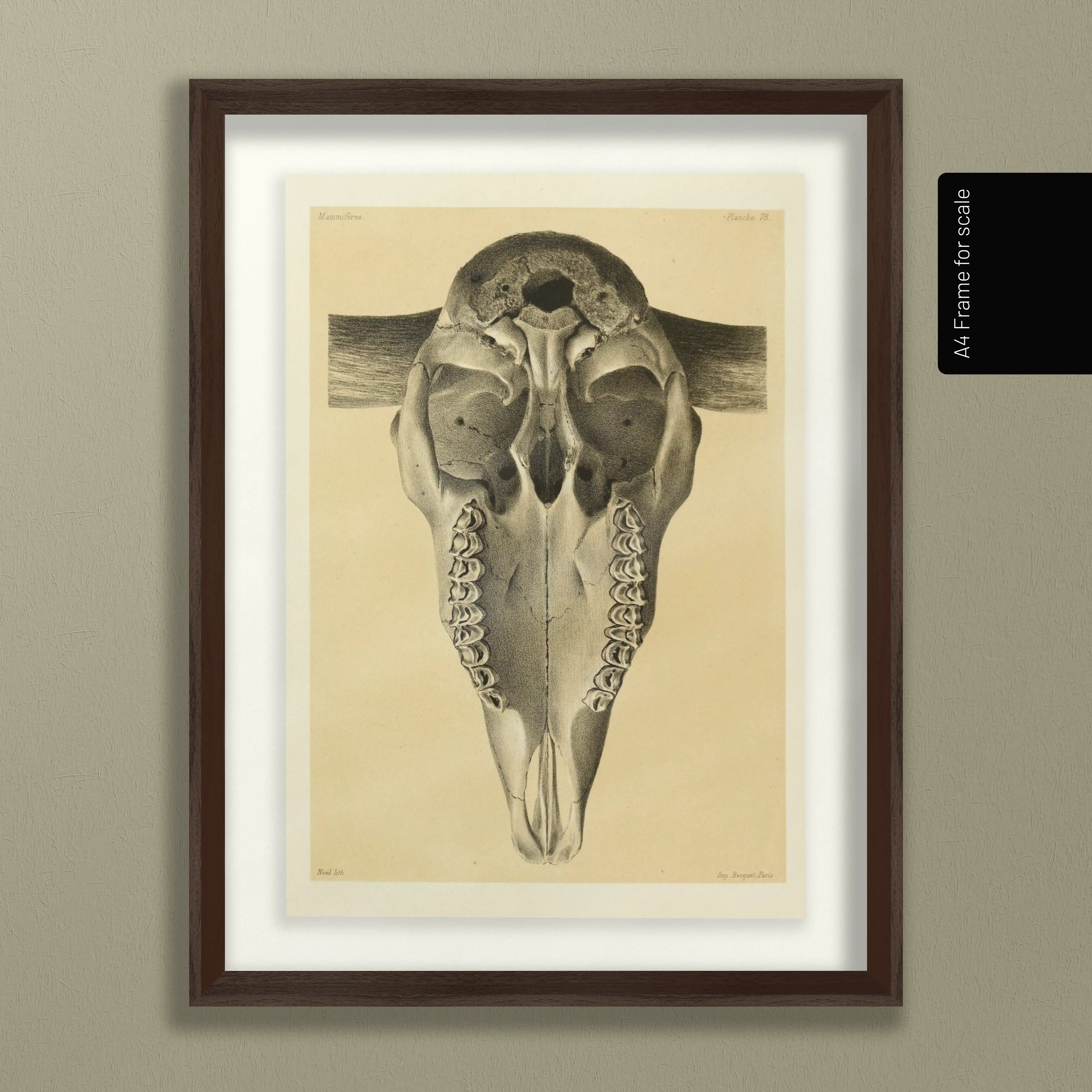 Anatomy: Plate No. 43