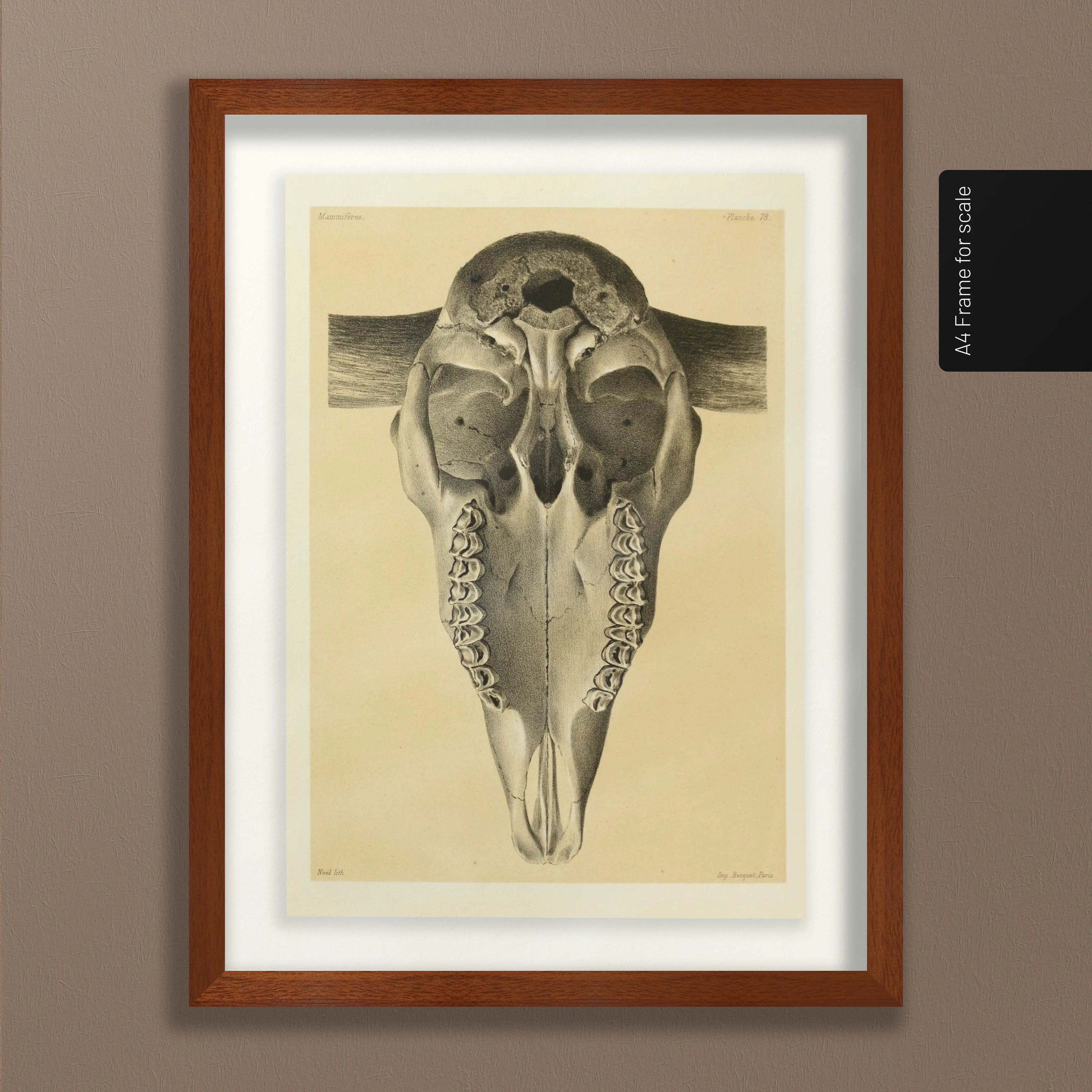 Anatomy: Plate No. 43