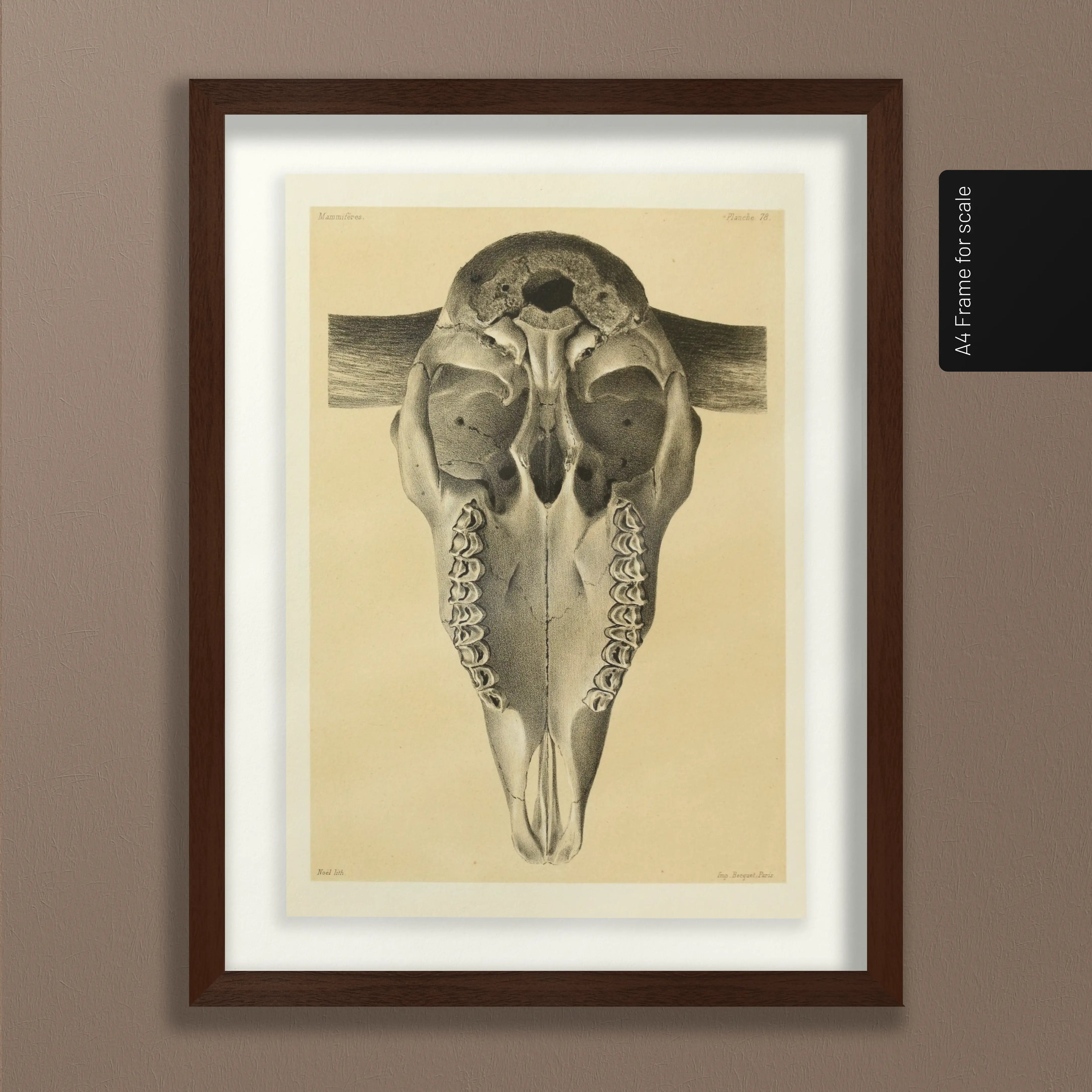 Anatomy: Plate No. 43