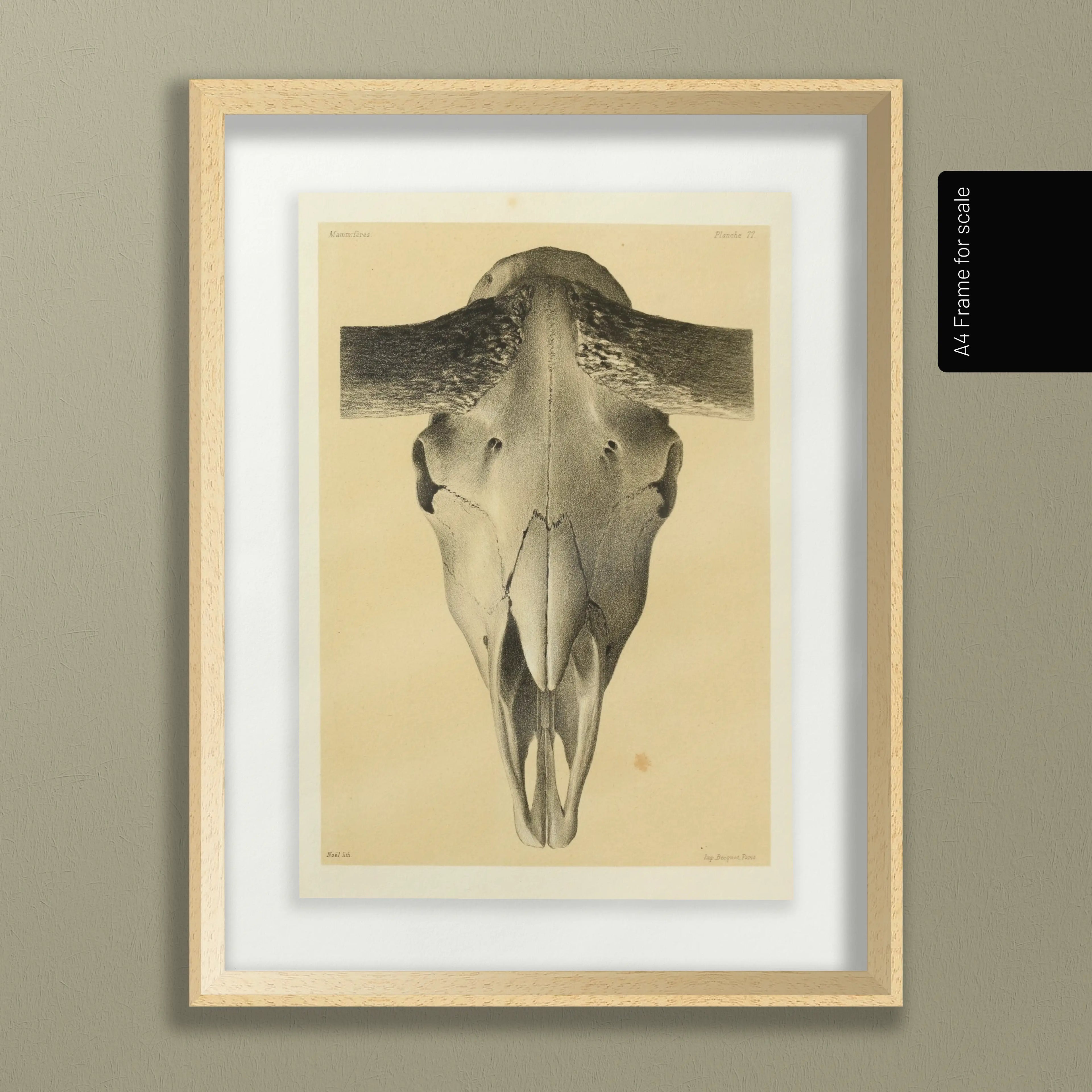 Anatomy: Plate No. 44