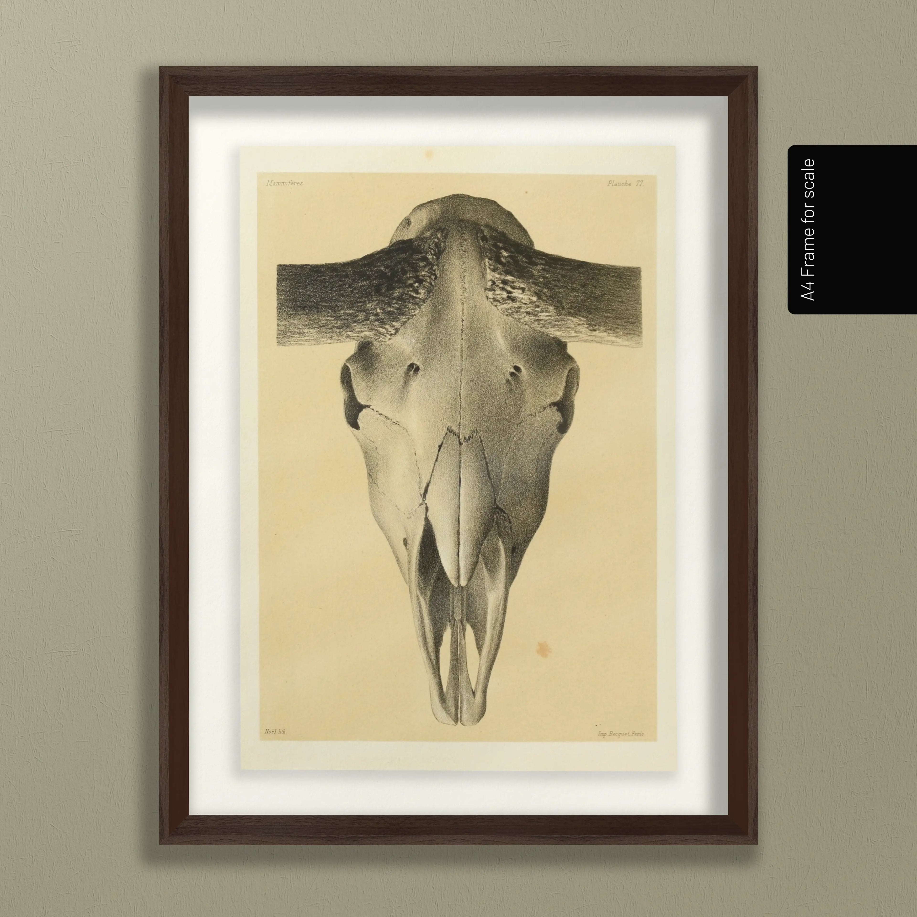 Anatomy: Plate No. 44