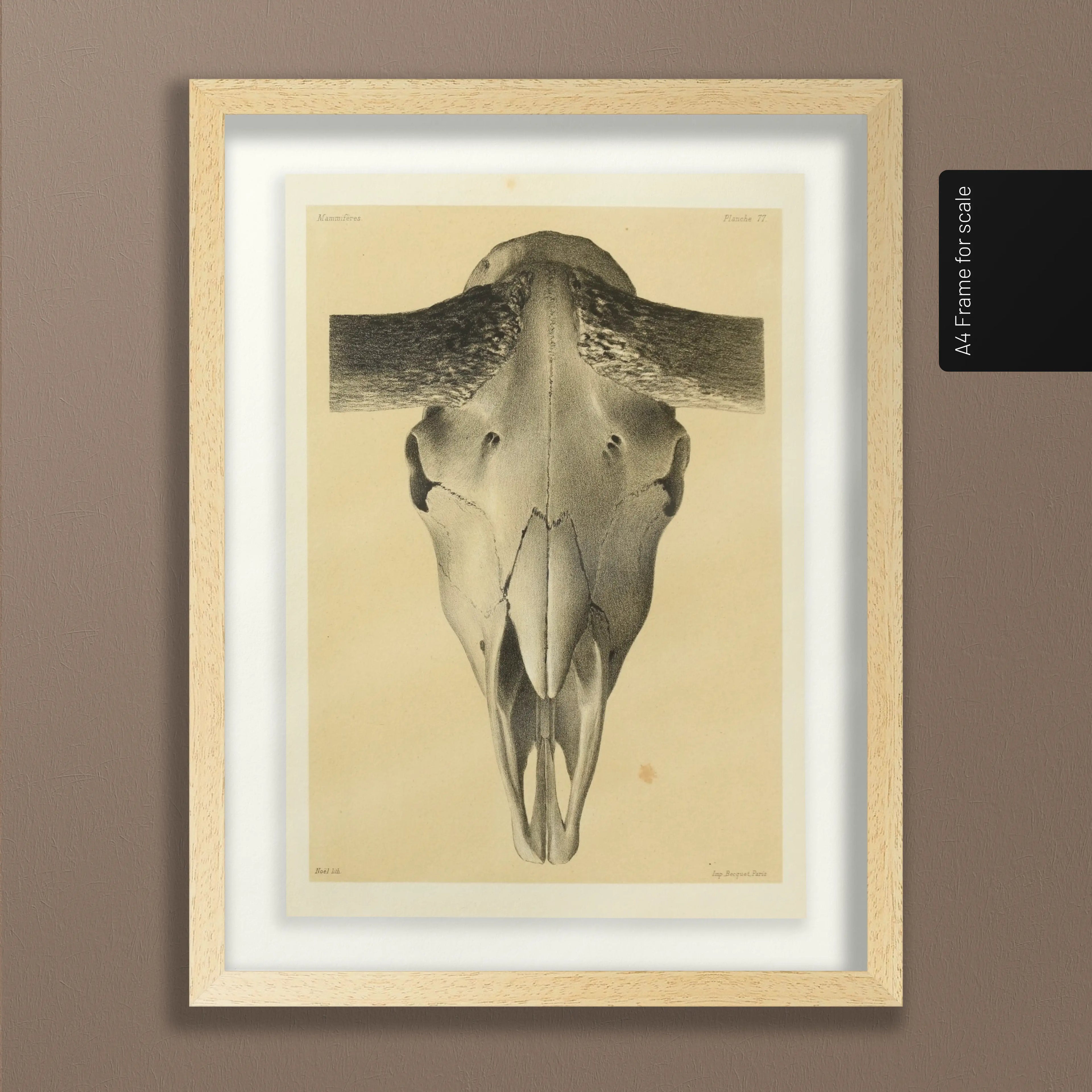 Anatomy: Plate No. 44