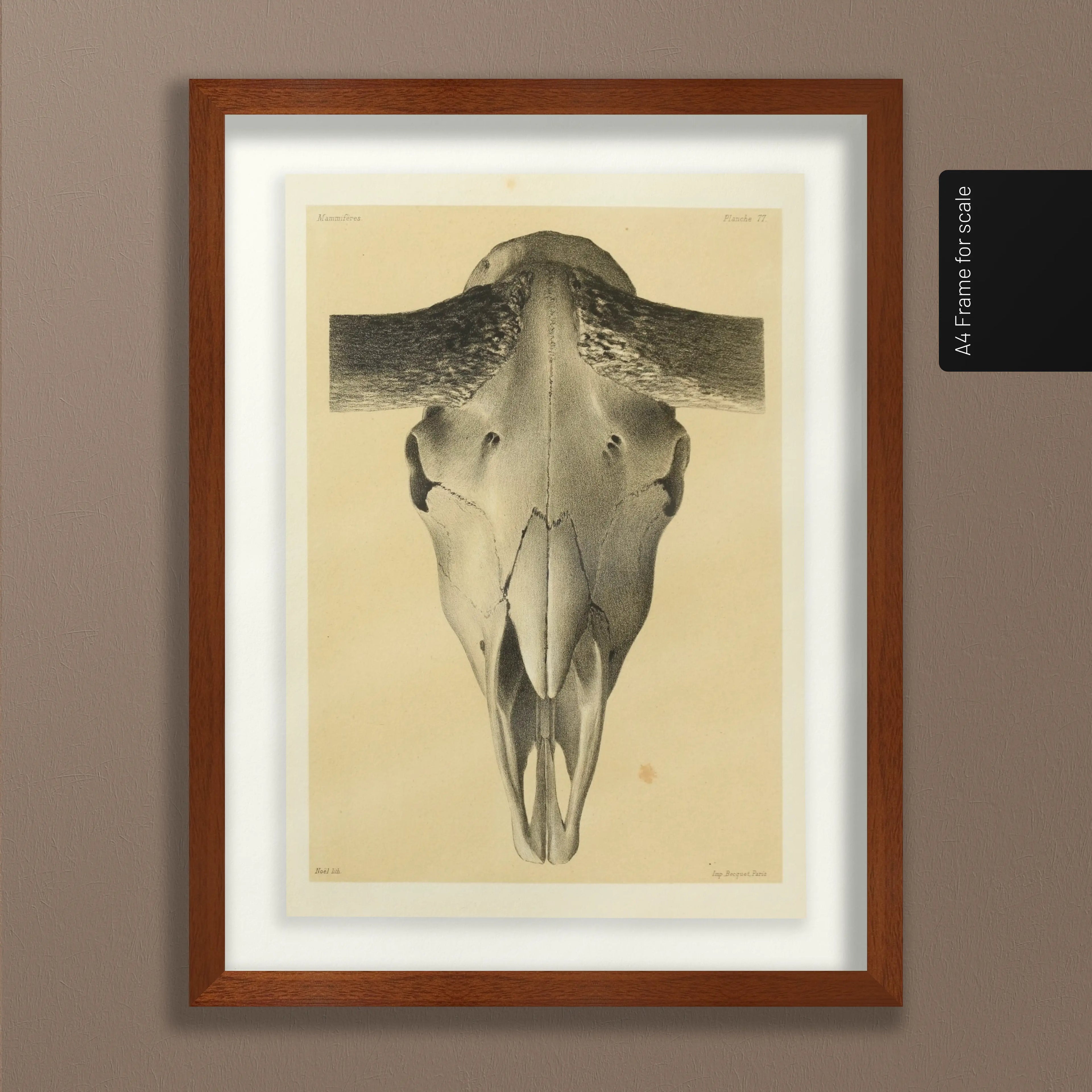 Anatomy: Plate No. 44