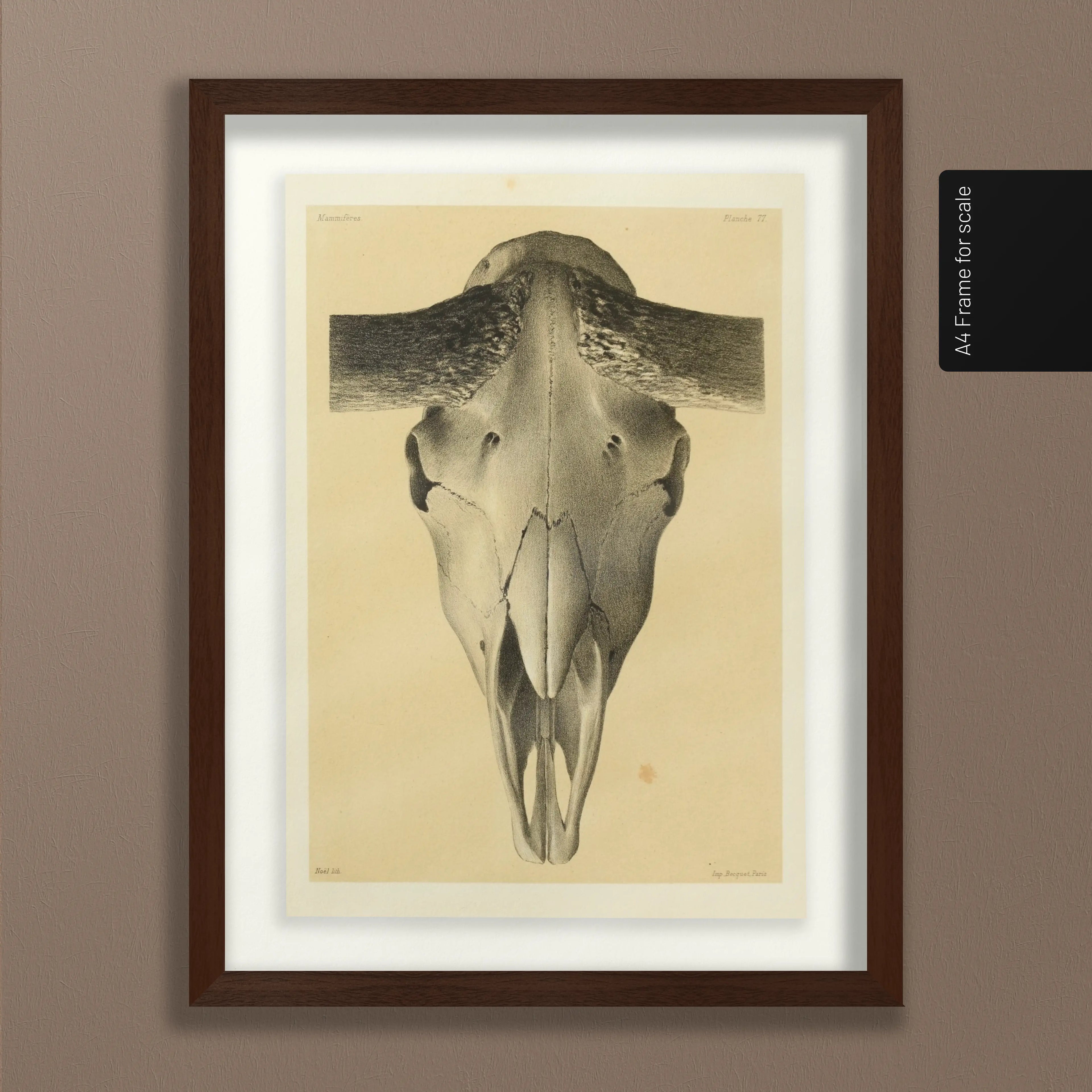 Anatomy: Plate No. 44