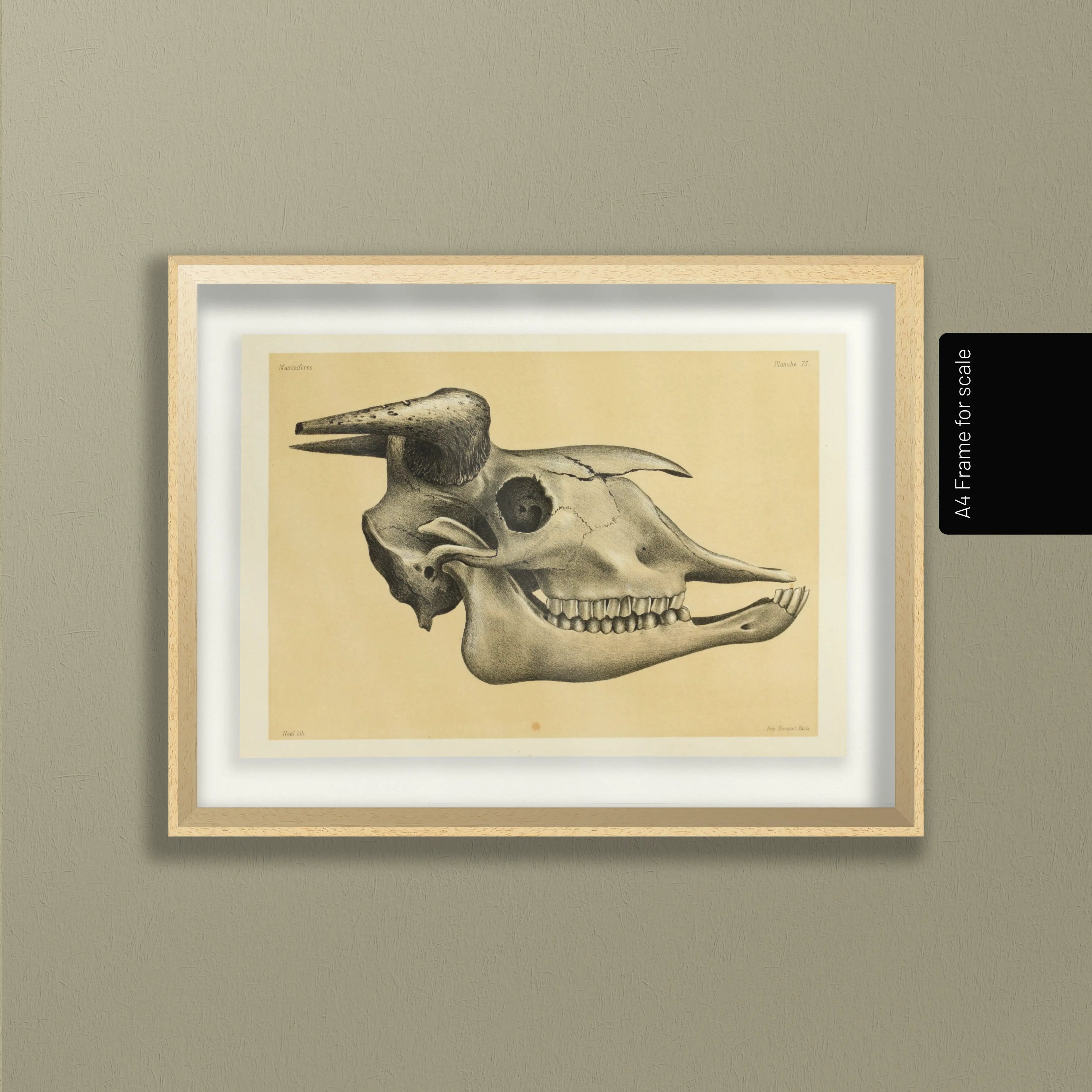 Anatomy: Plate No. 46
