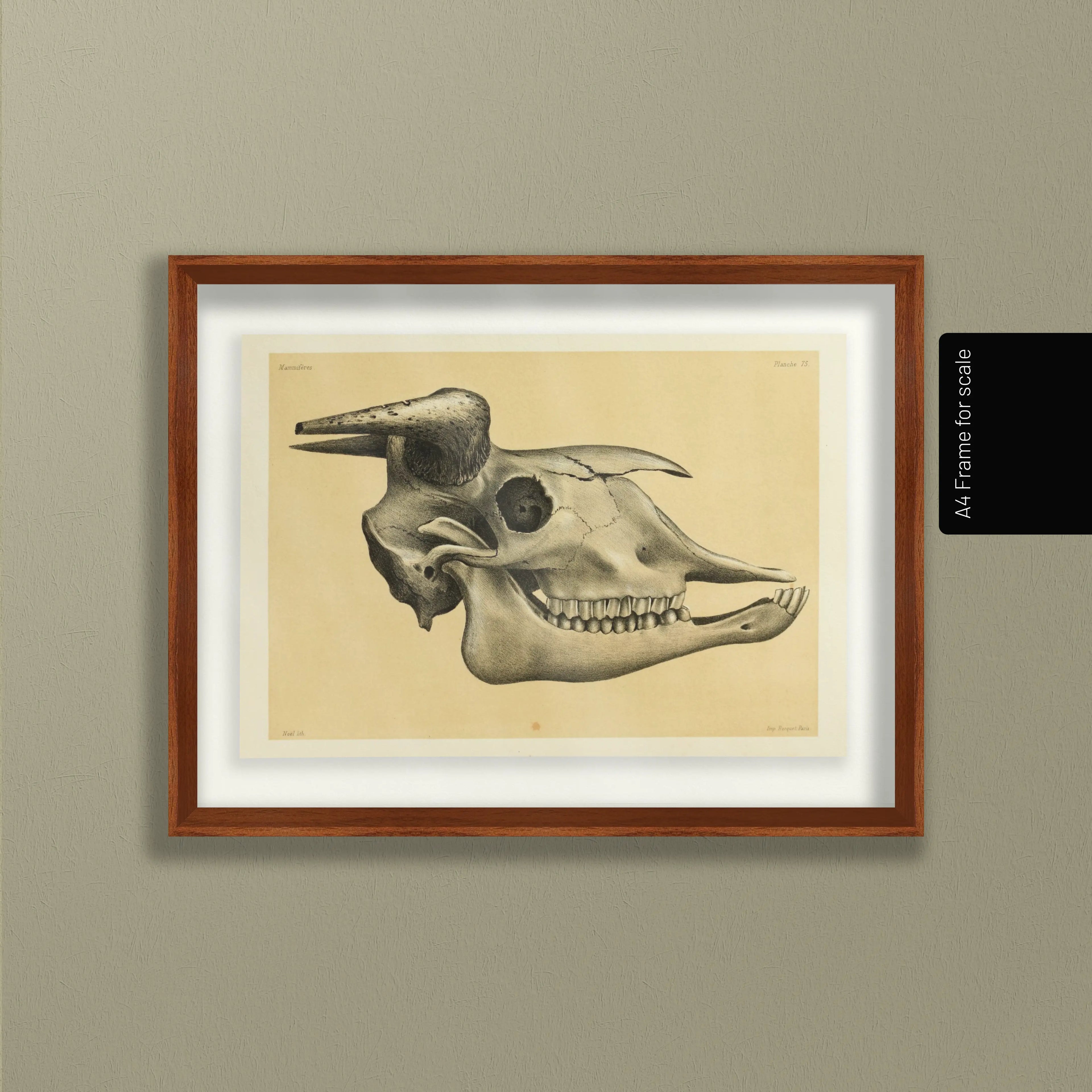 Anatomy: Plate No. 46