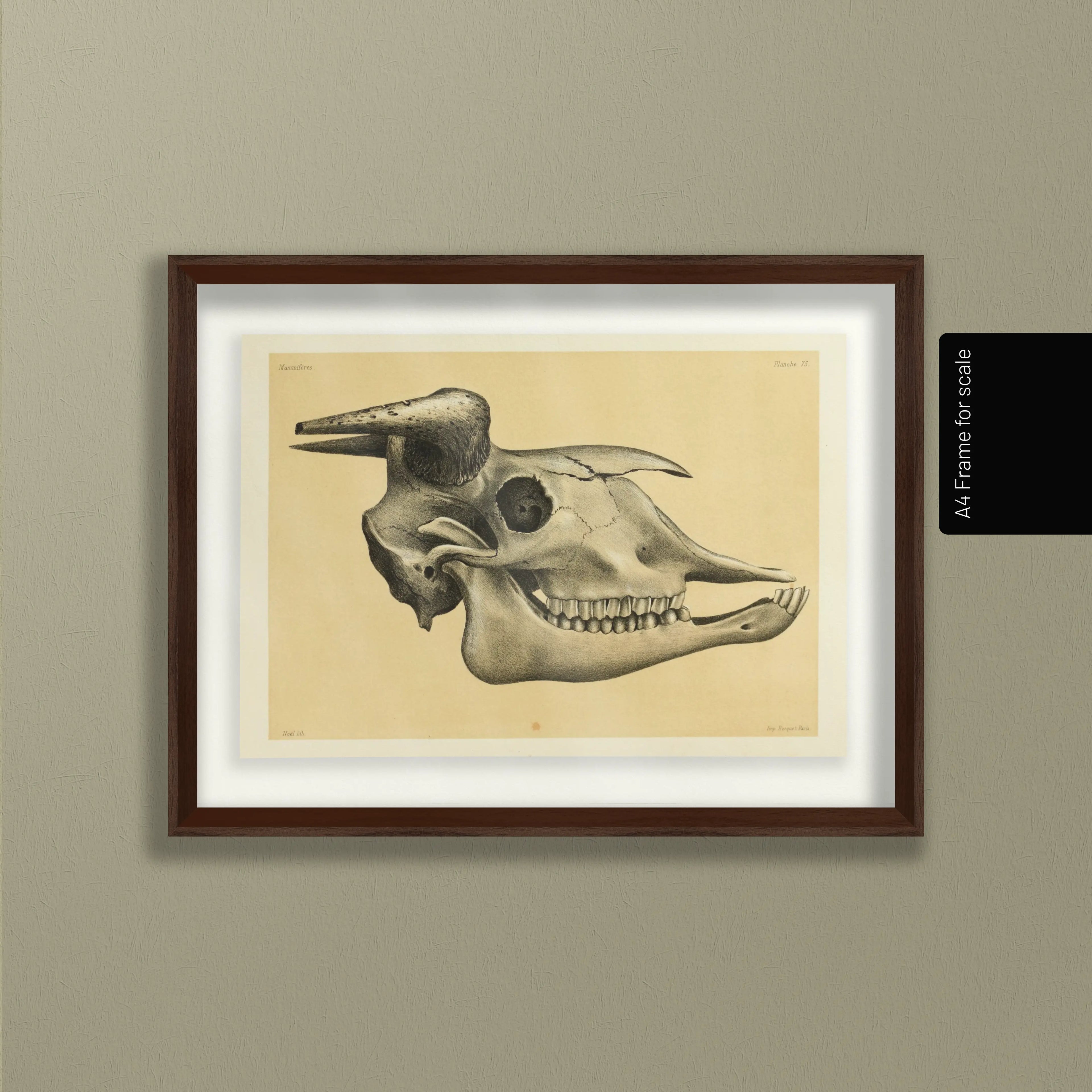 Anatomy: Plate No. 46
