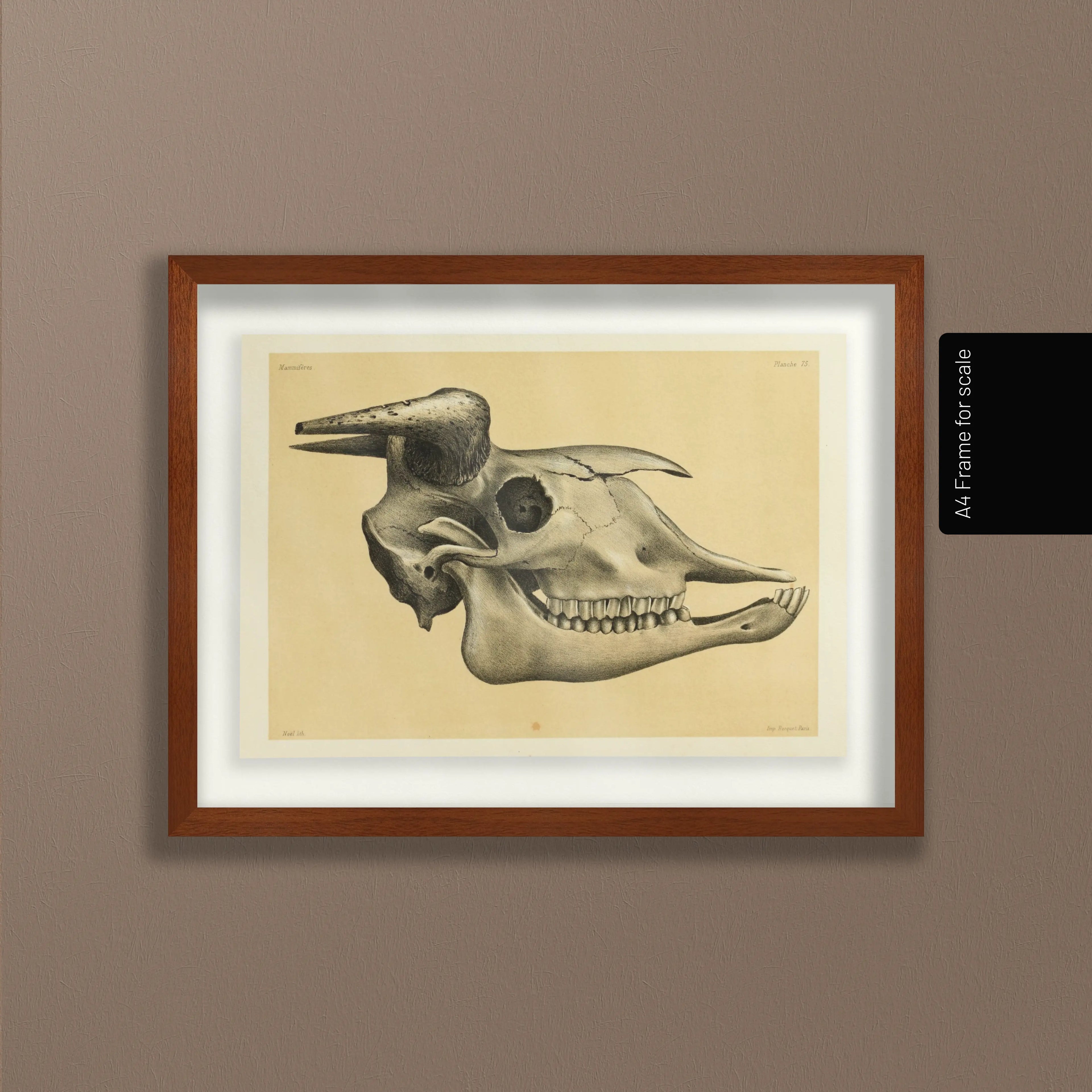 Anatomy: Plate No. 46