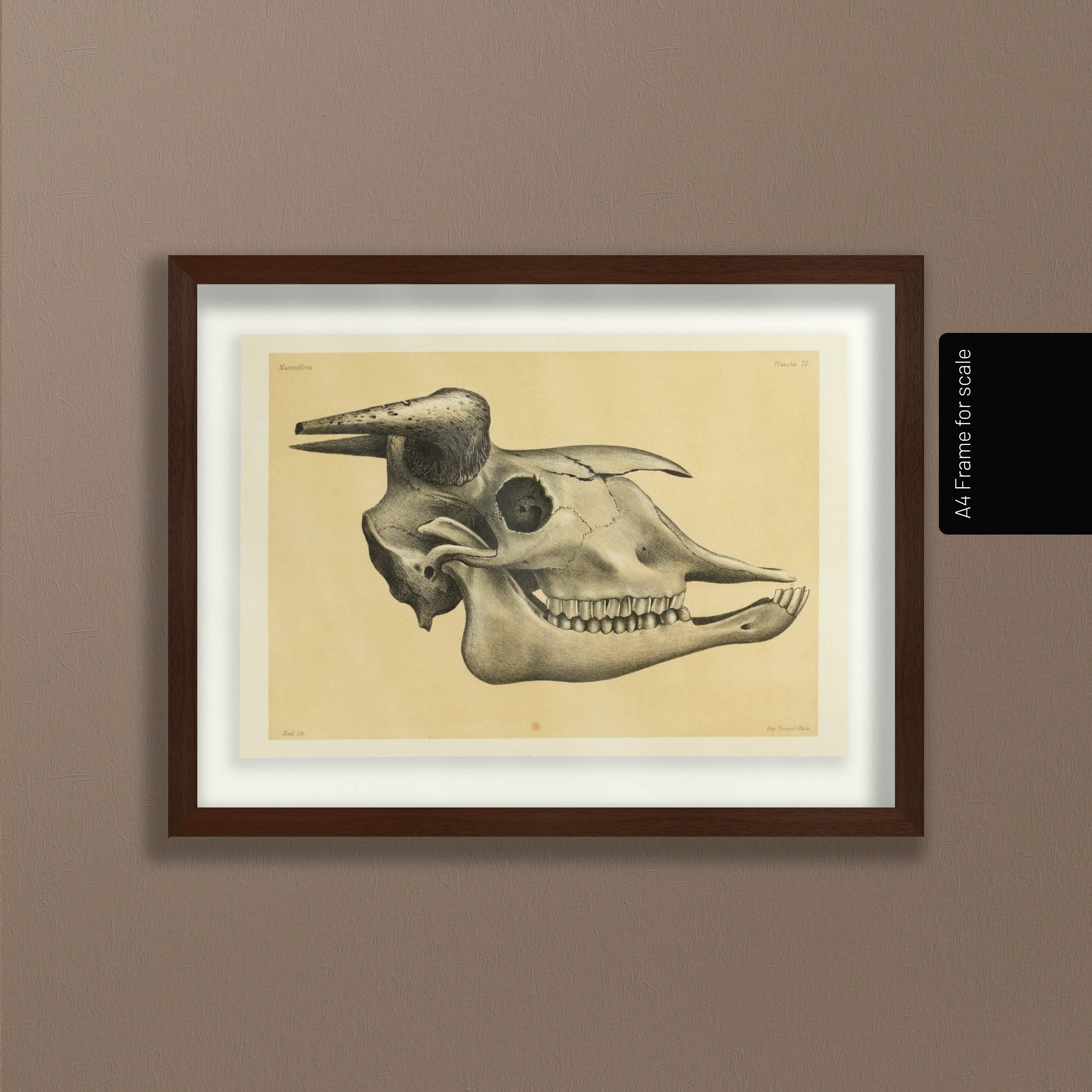 Anatomy: Plate No. 46