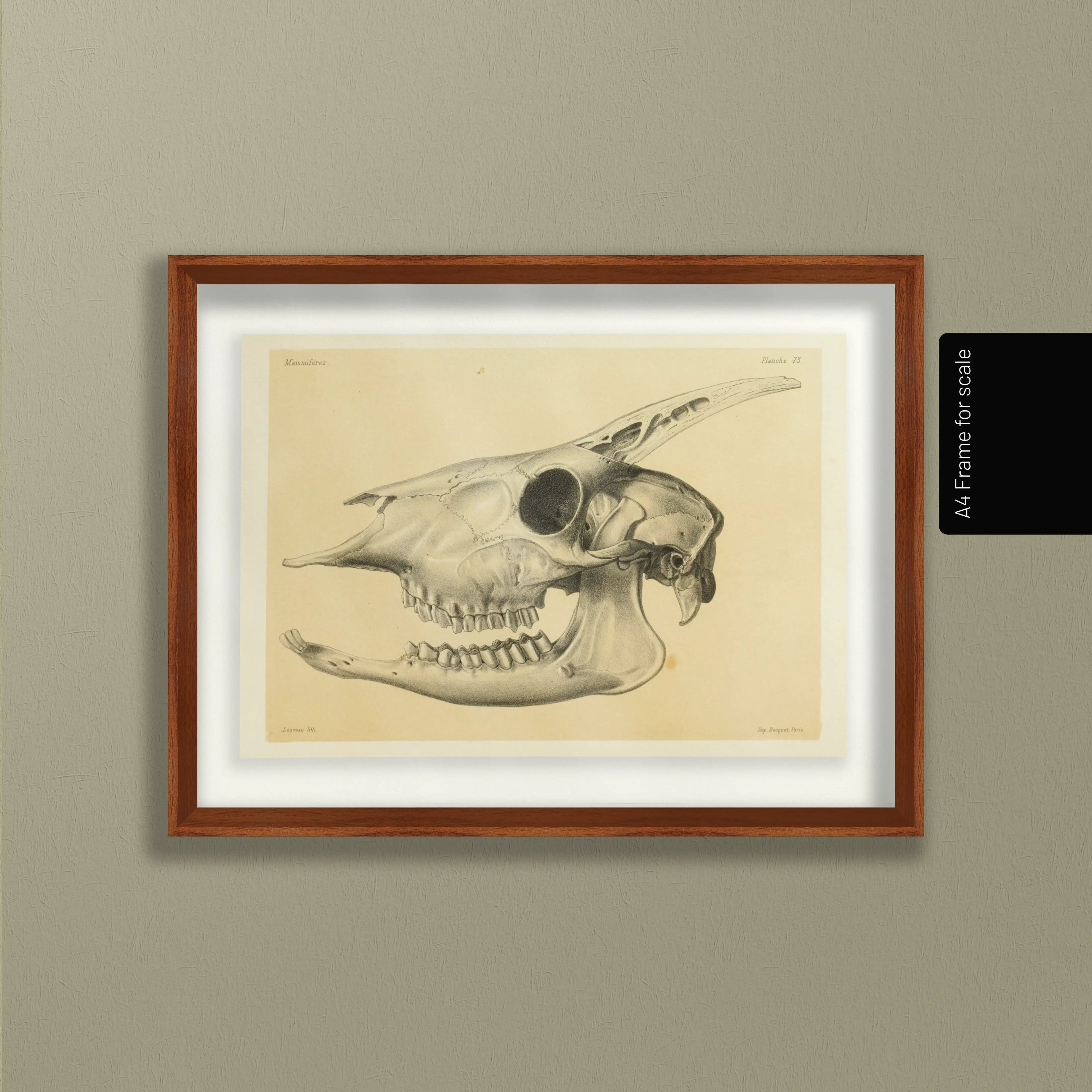 Anatomy: Plate No. 47